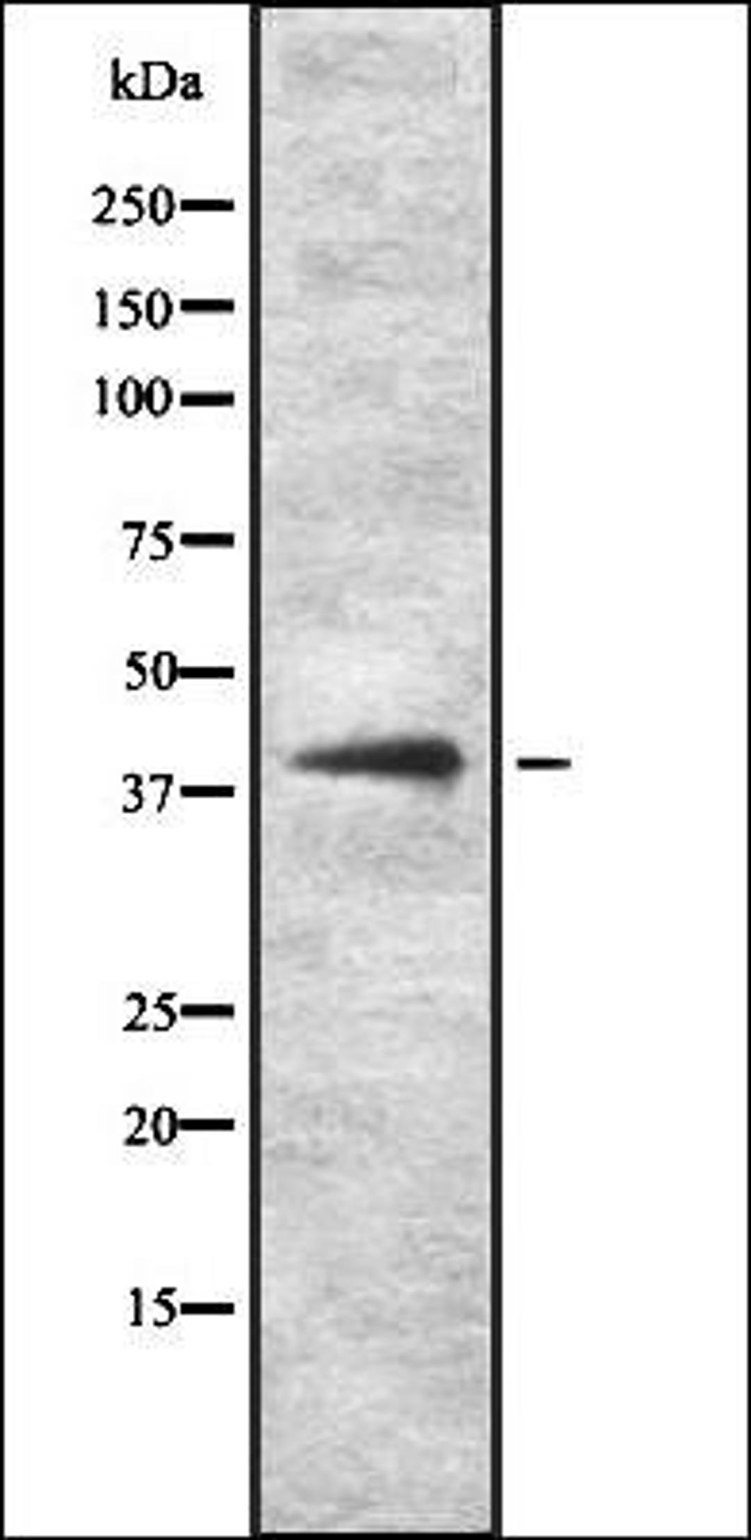 Western blot analysis of HEK293 cells using KITH_HHV1K antibody