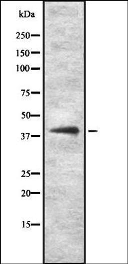 Western blot analysis of HEK293 cells using KITH_HHV1K antibody