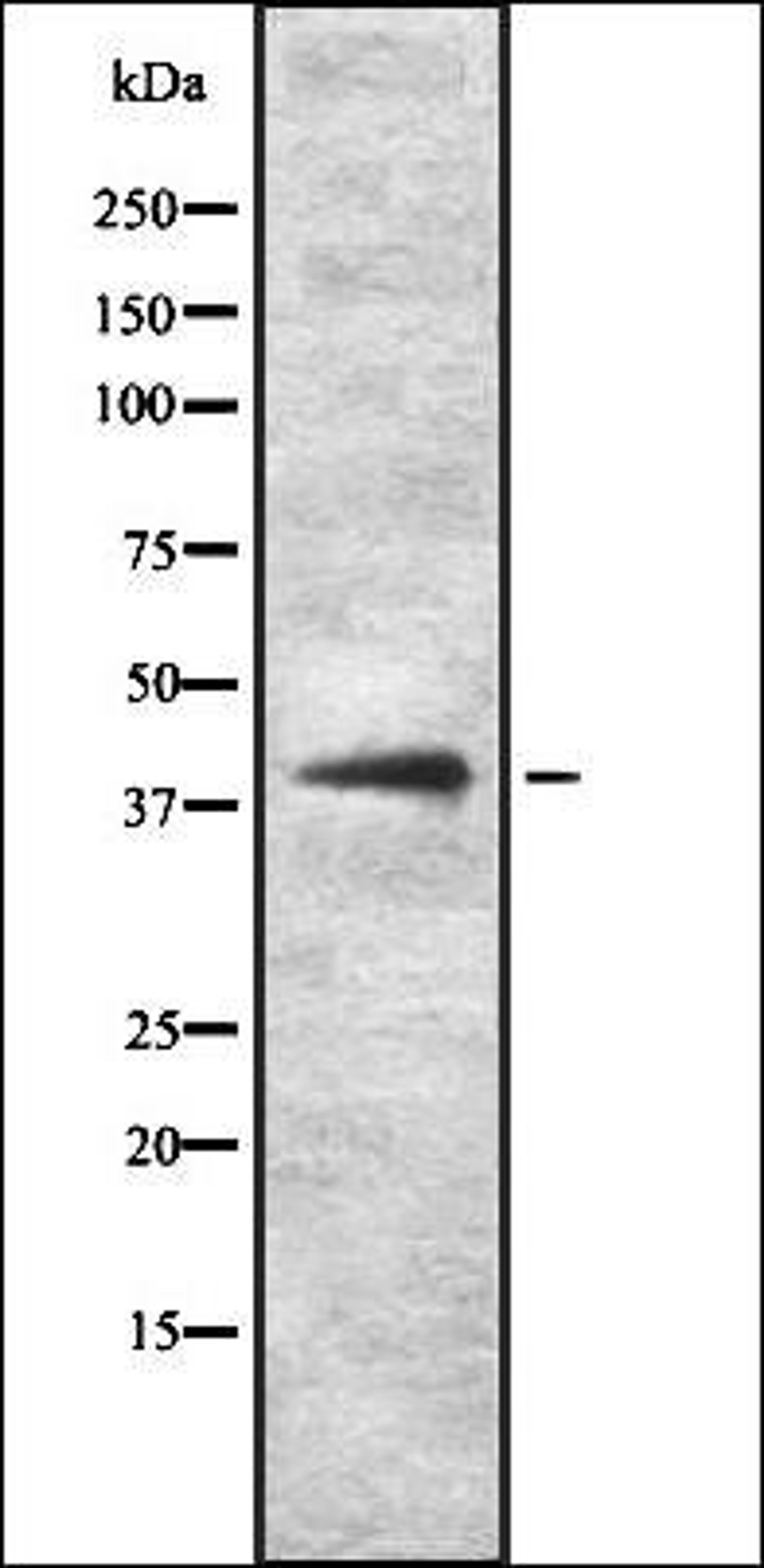 Western blot analysis of HEK293 cells using KITH_HHV1K antibody