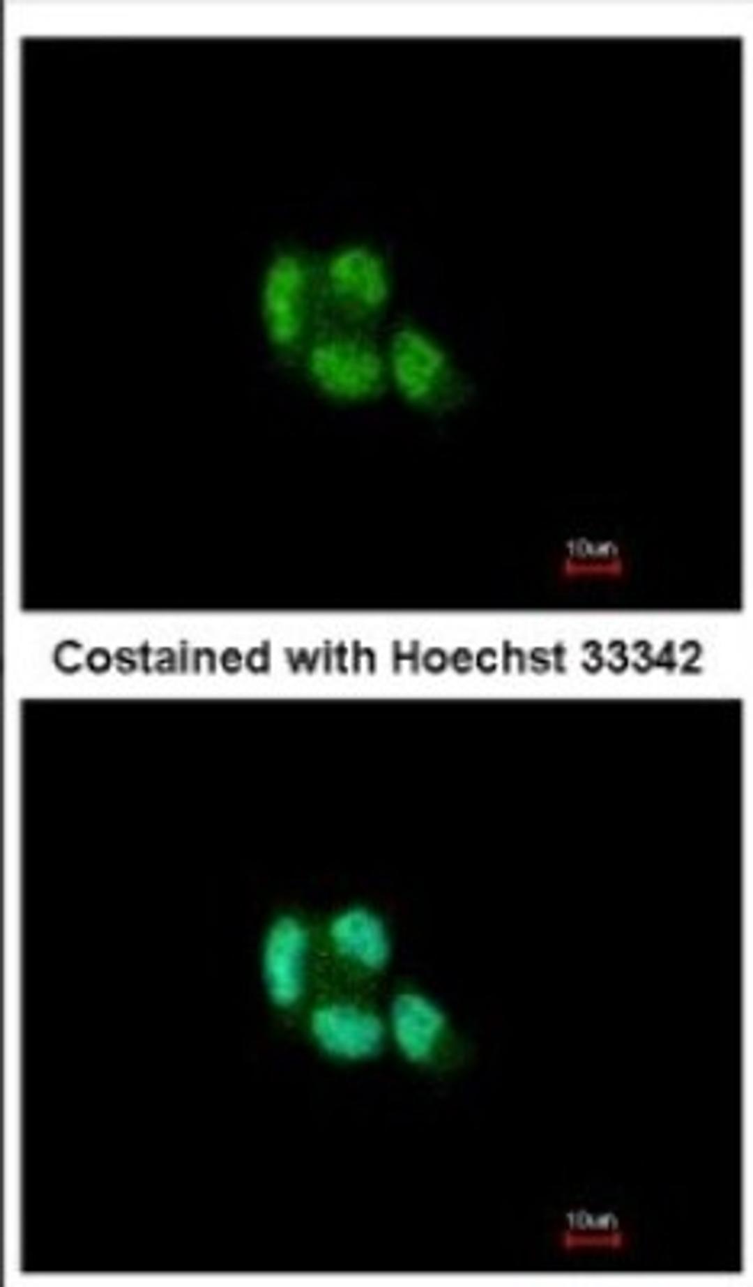 Immunocytochemistry/Immunofluorescence: PSMB5 Antibody [NBP2-19983] - Immunofluorescence analysis of paraformaldehyde-fixed A431, using antibody at 1:200 dilution.