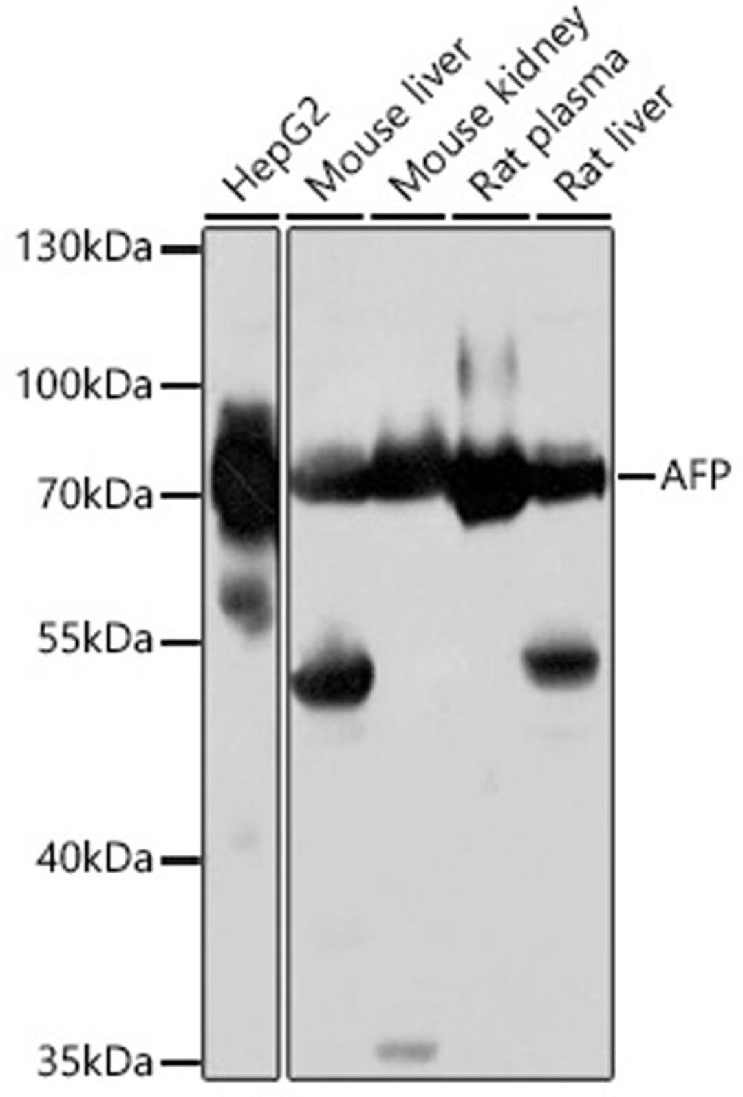 Western blot - AFP antibody (A16750)