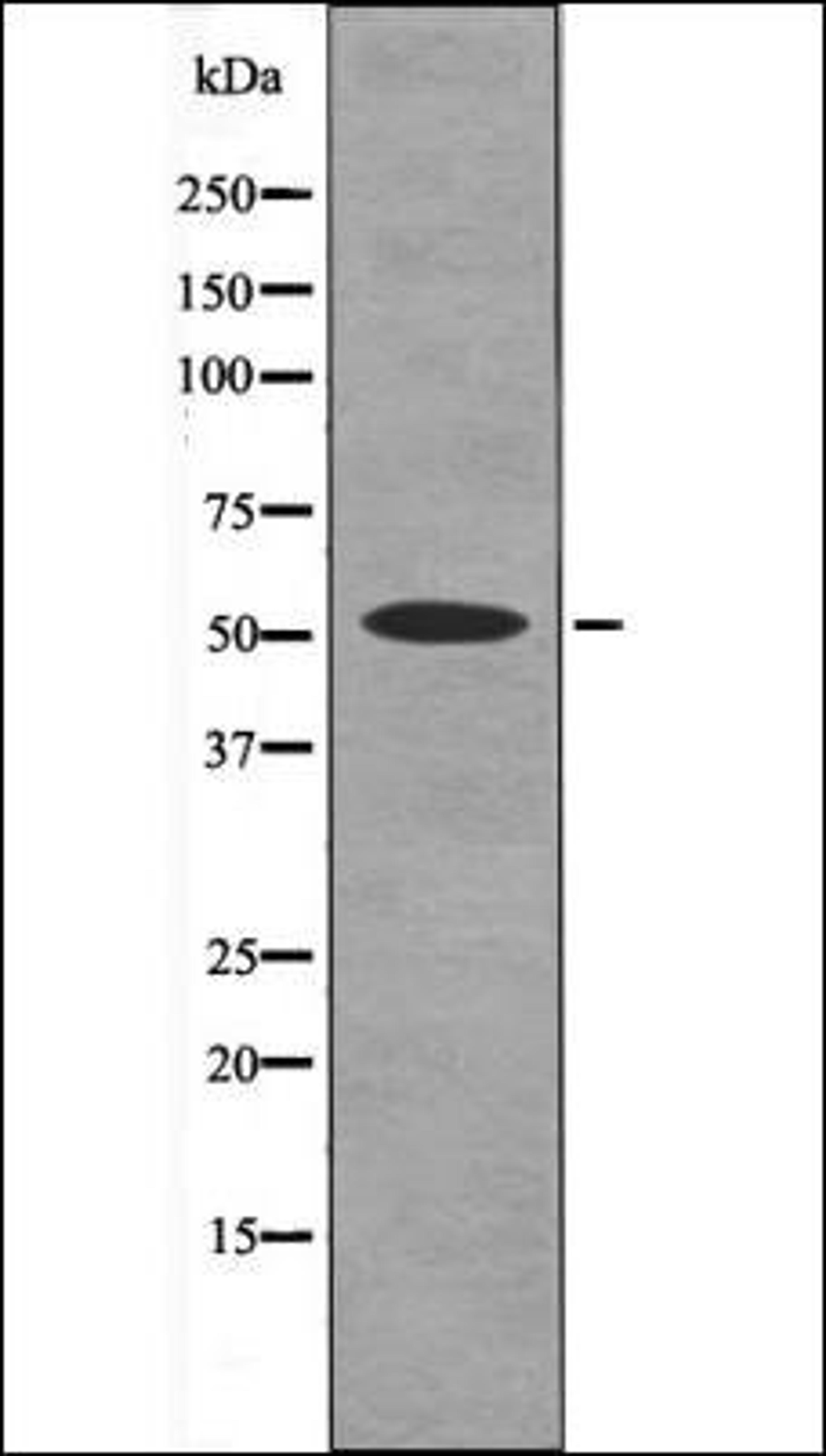 Western blot analysis of EGF treated HepG2 whole cell lysates using NDR1/2 -Phospho-Thr444/442- antibody