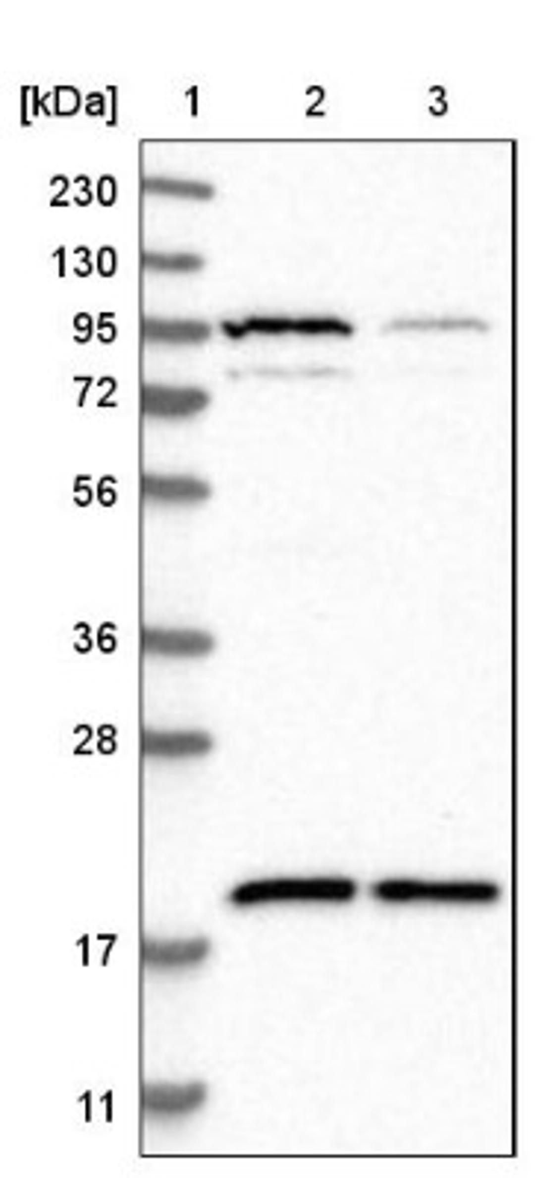 Immunohistochemistry: ARP10 Antibody [NBP1-91682] - Lane 1: Marker [kDa] 230, 130, 95, 72, 56, 36, 28, 17, 11<br/>Lane 2: Human cell line RT-4<br/>Lane 3: Human cell line U-251MG sp