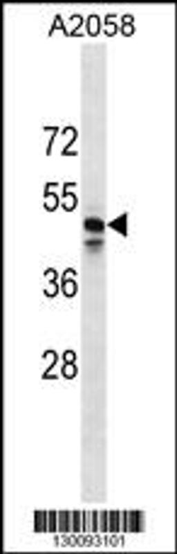 Western blot analysis in A2058 cell line lysates (35ug/lane).