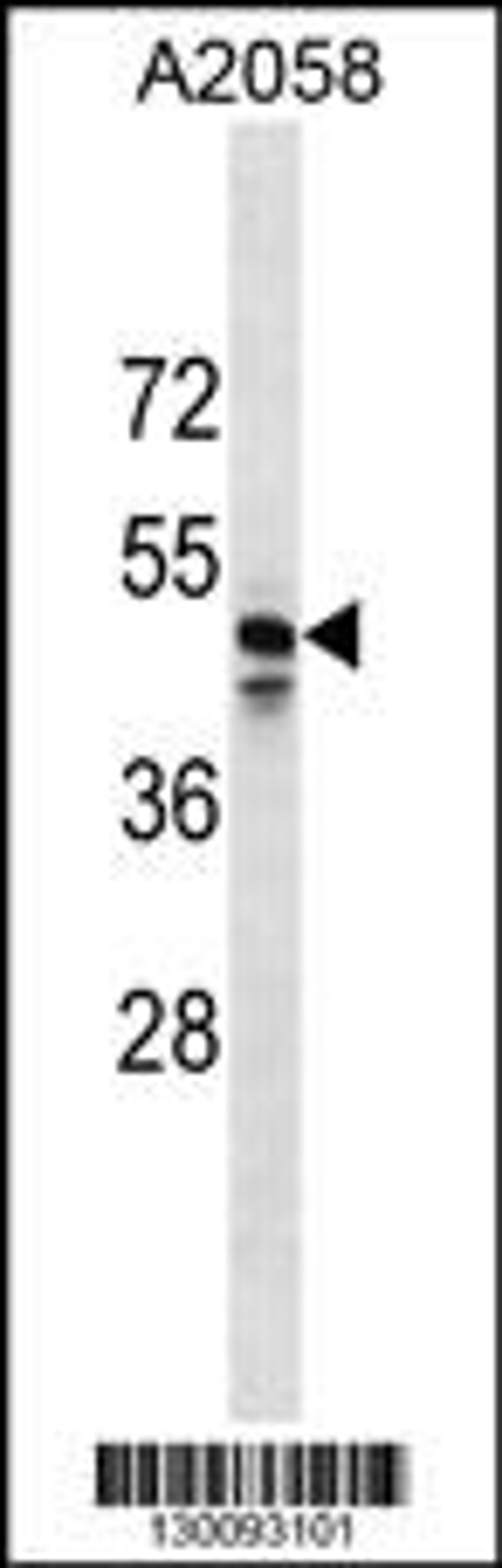 Western blot analysis in A2058 cell line lysates (35ug/lane).