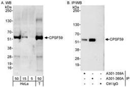 Detection of human CPSF59 by western blot and immunoprecipitation.