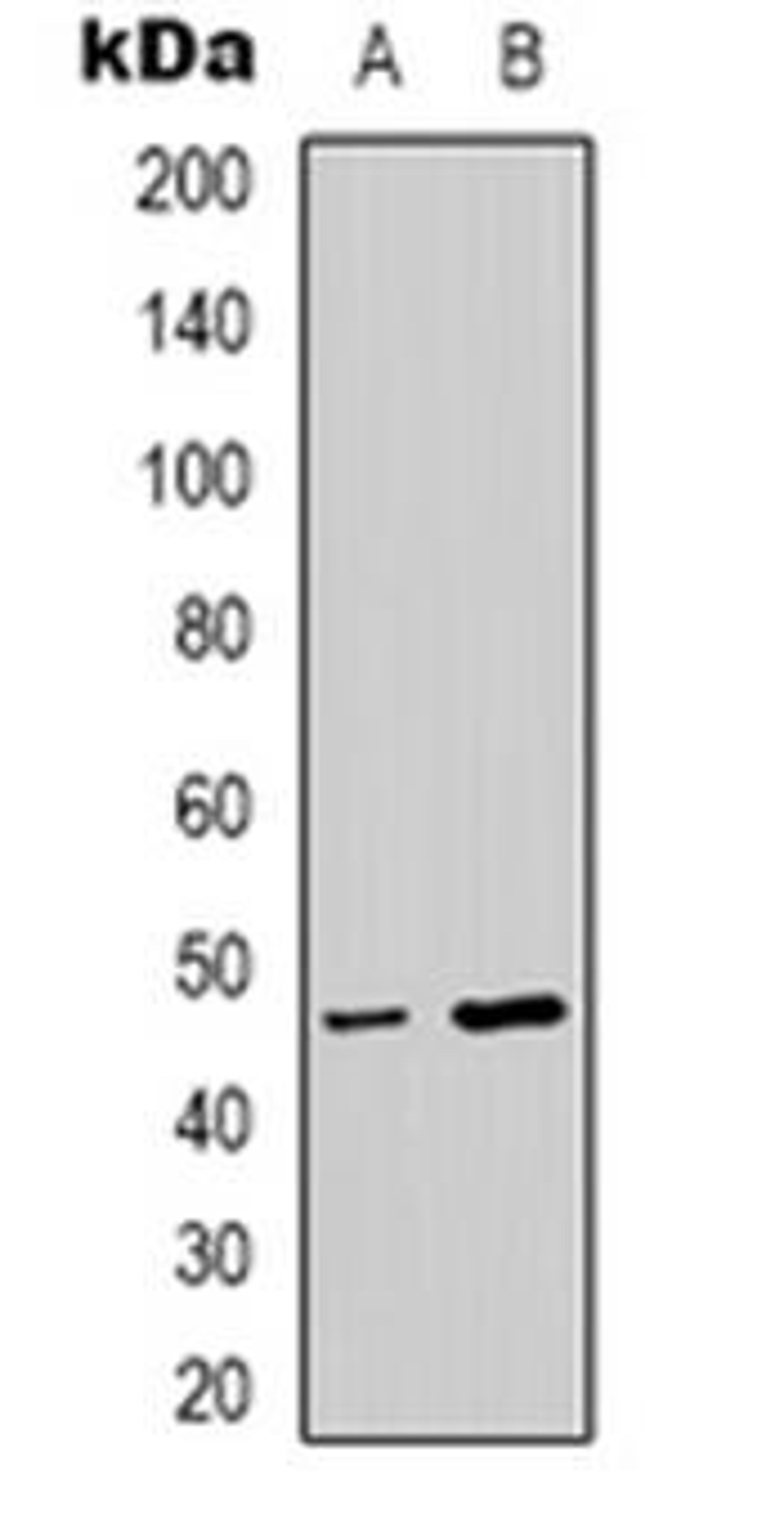 Western blot analysis of p47 phox (pS345) expression in HepG2 (Lane 1), NIH3T3 (Lane 2) whole cell lysates using NCF1 (phospho-S345) antibody