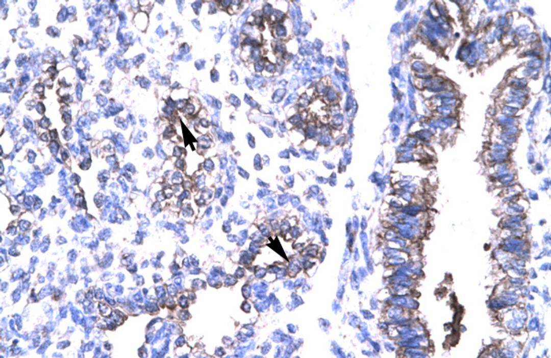 Antibody used in IHC on Human Lung.