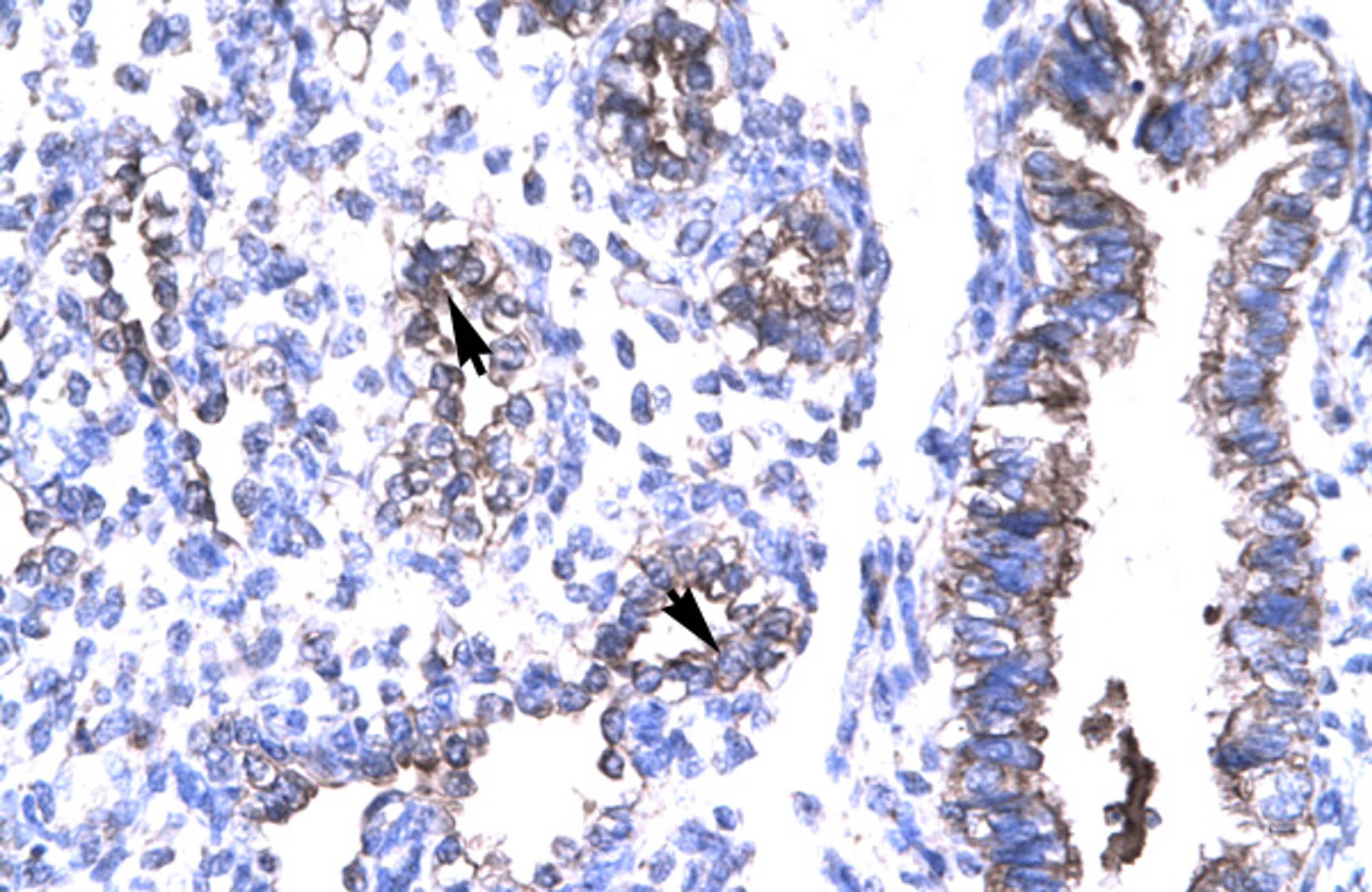 Antibody used in IHC on Human Lung.