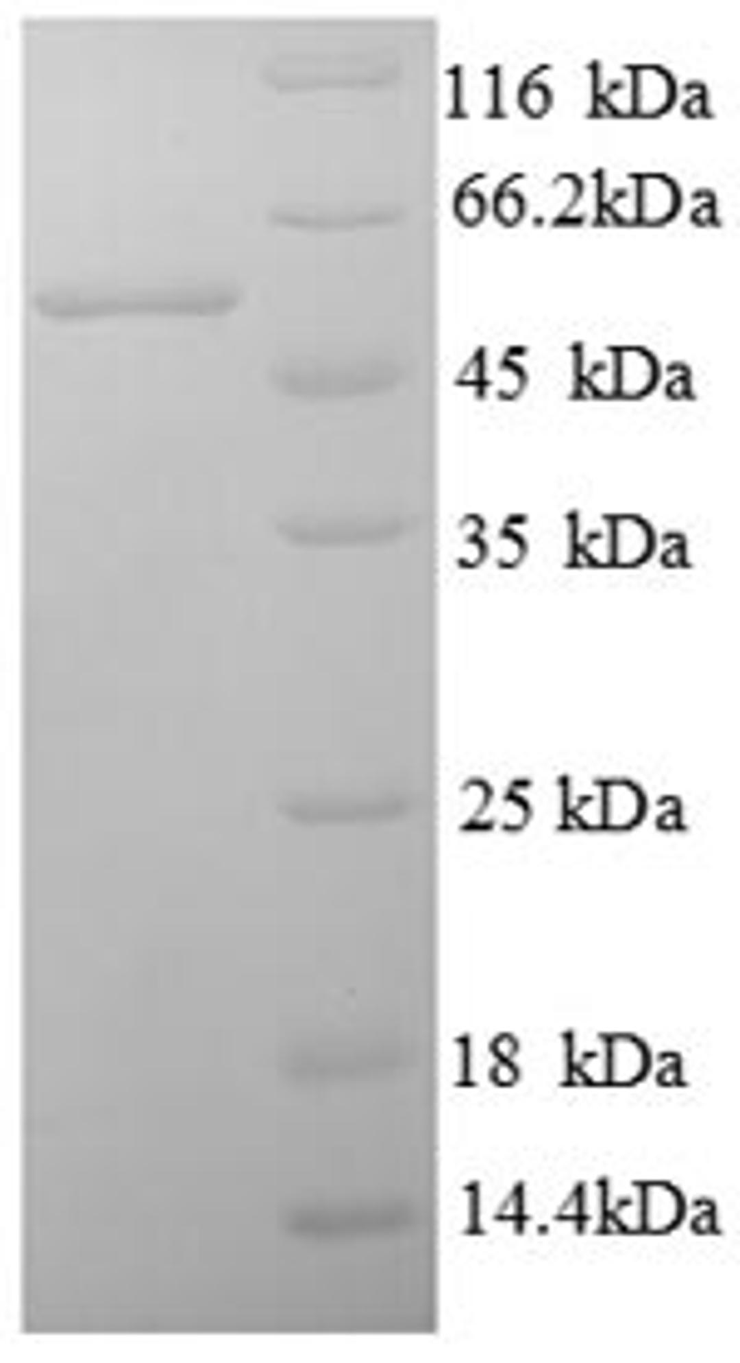 (Tris-Glycine gel) Discontinuous SDS-PAGE (reduced) with 5% enrichment gel and 15% separation gel.