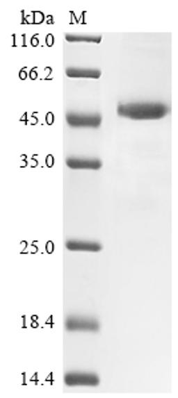 (Tris-Glycine gel) Discontinuous SDS-PAGE (reduced) with 5% enrichment gel and 15% separation gel.