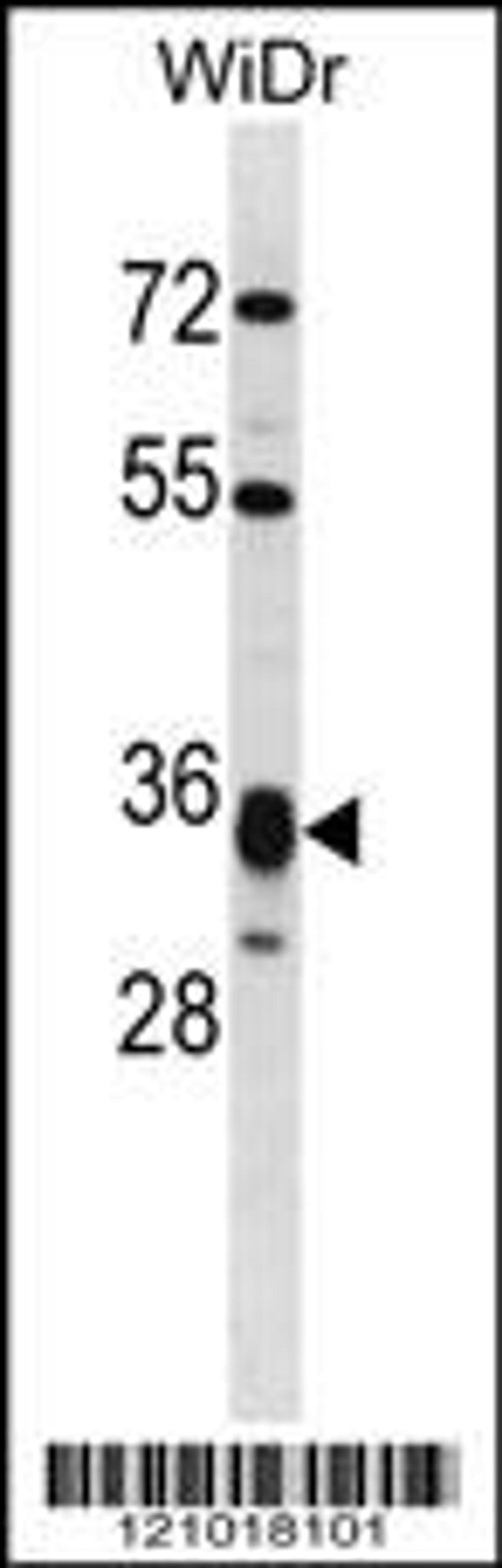 Western blot analysis in WiDr cell line lysates (35ug/lane).