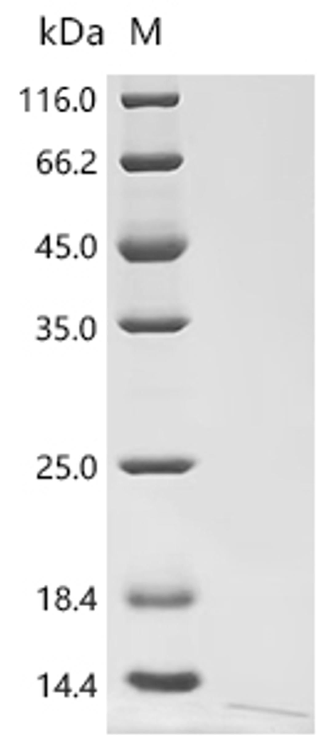 (Tris-Glycine gel) Discontinuous SDS-PAGE (reduced) with 5% enrichment gel and 15% separation gel.