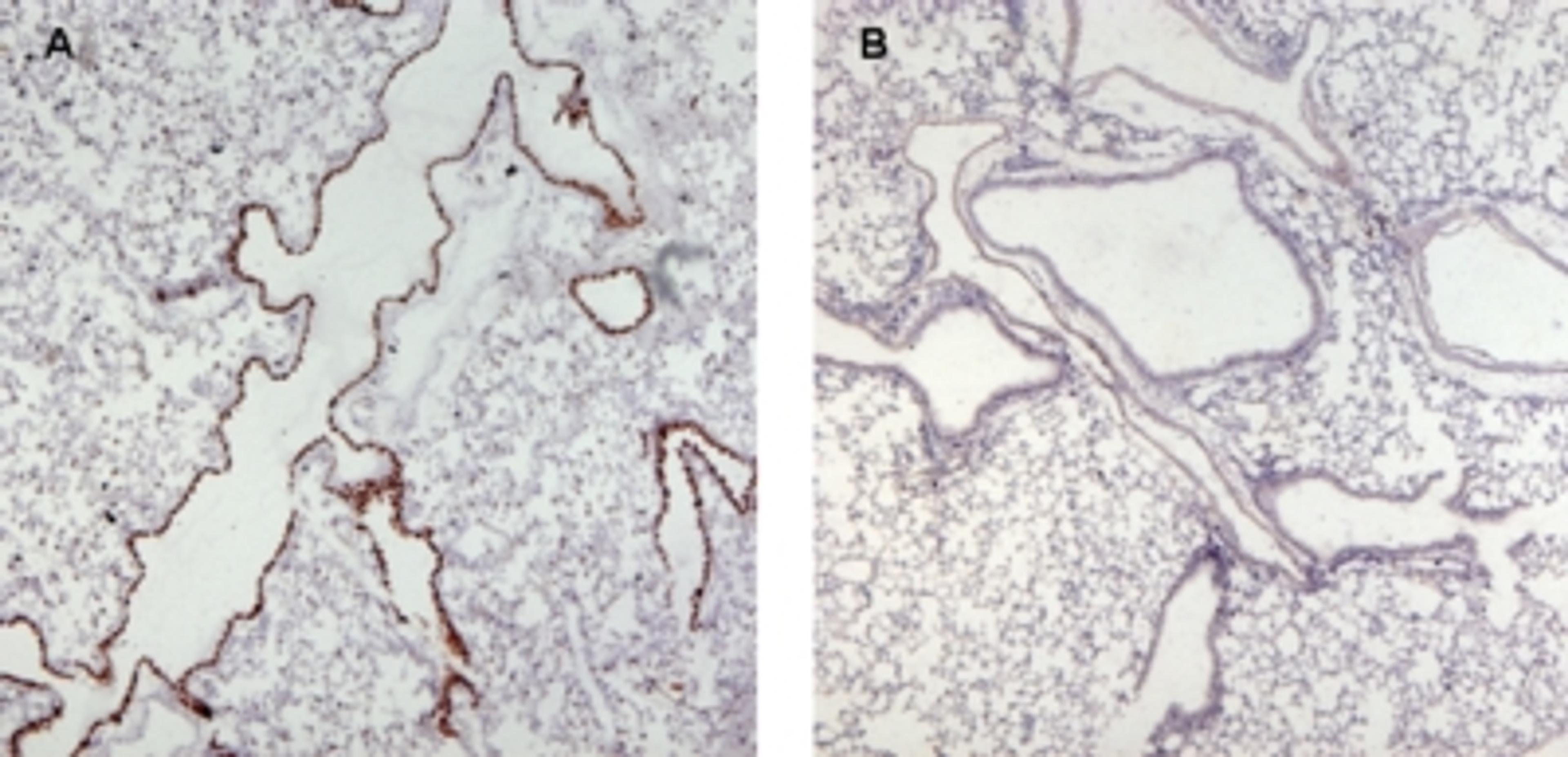 46-552 (0.5ug/ml) staining of paraffin embedded Mouse Lung (wt in A and KO in B) .