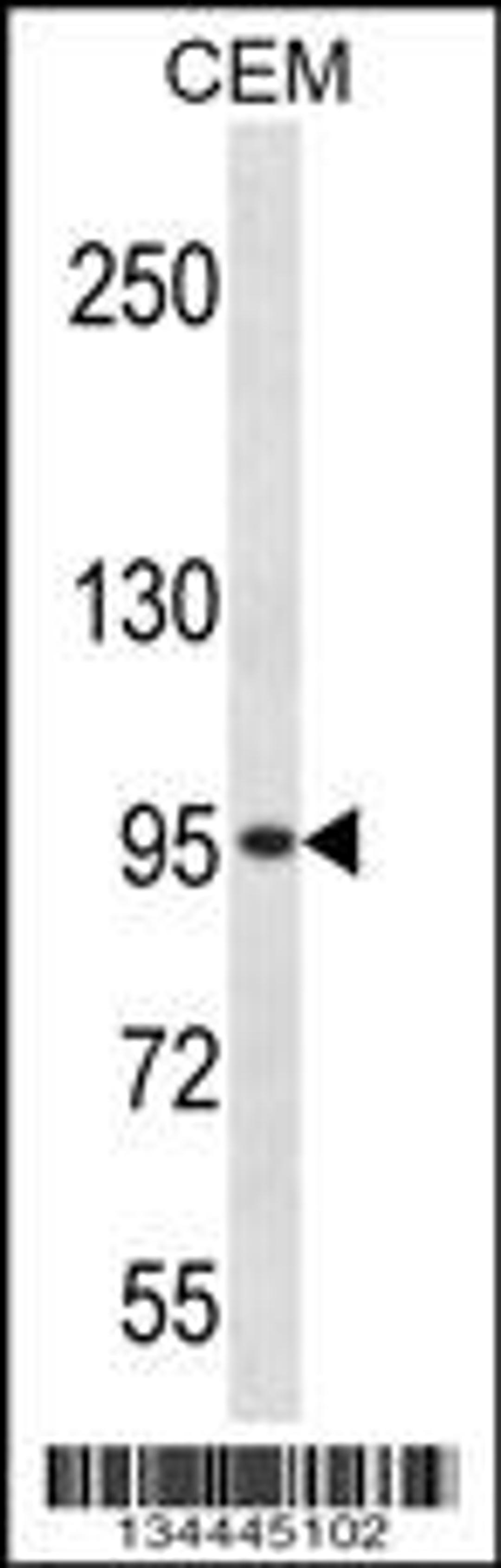 Western blot analysis in CEM cell line lysates (35ug/lane).