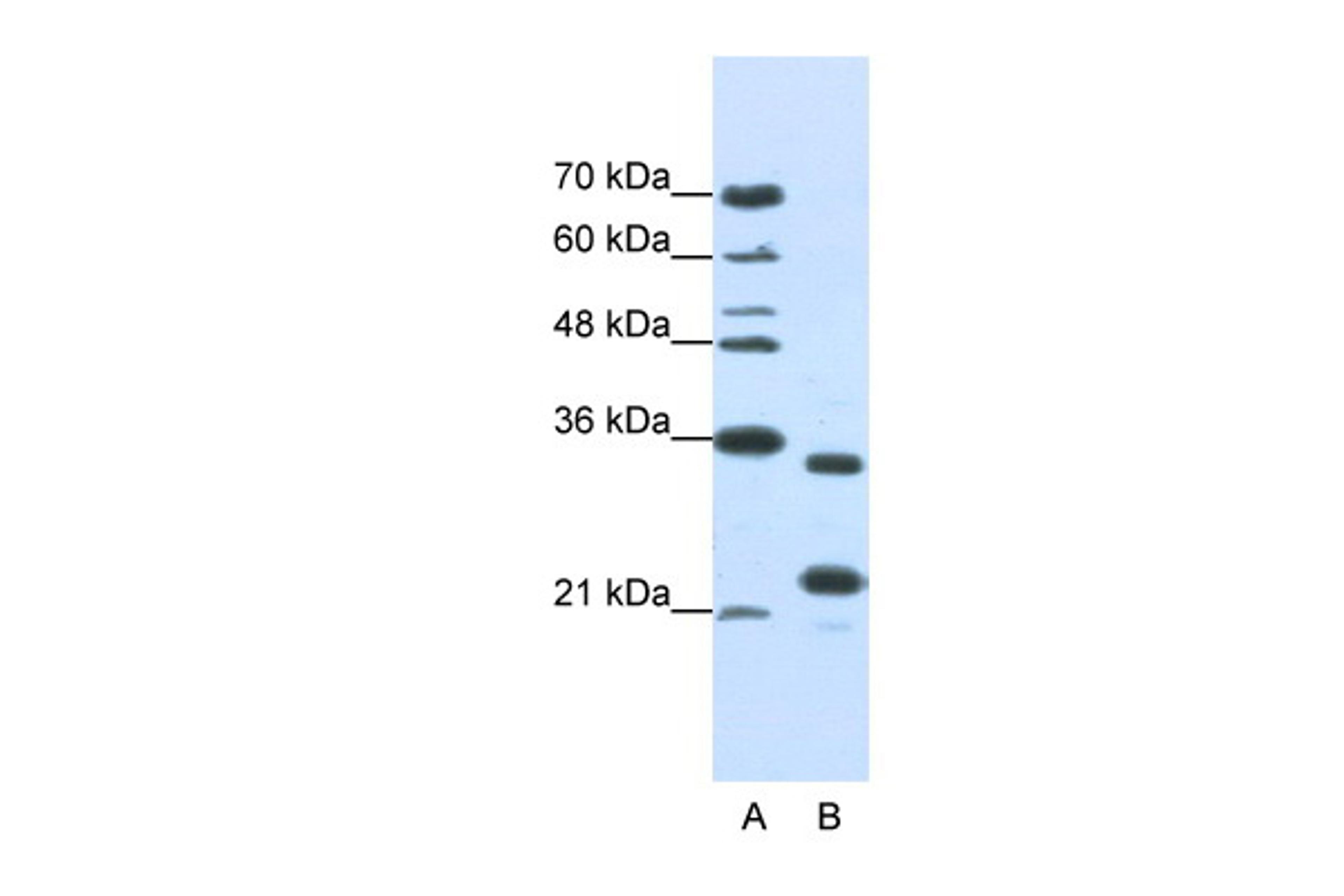 Antibody used in WB on Human Jurkat 1 ug/ml.