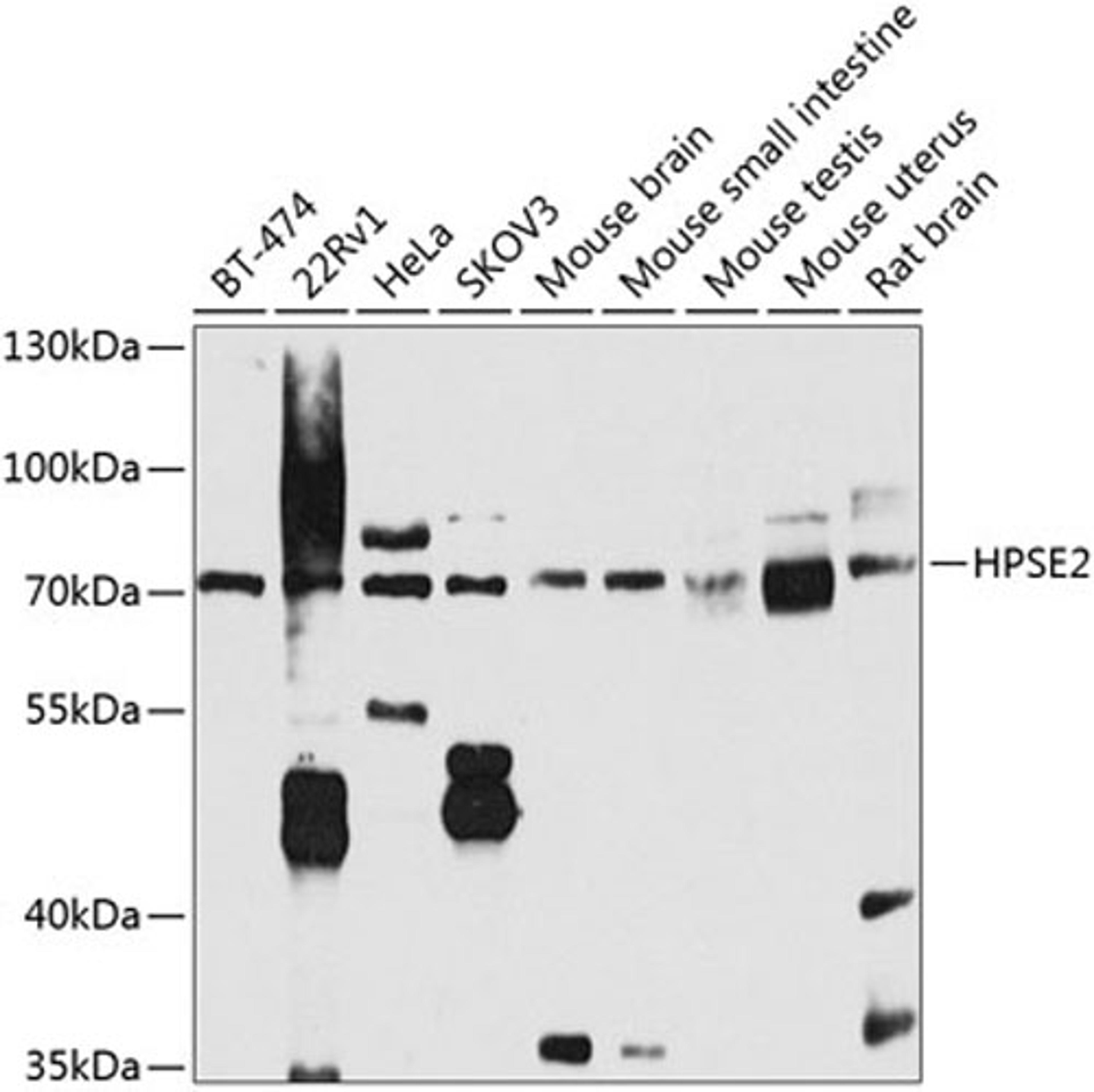 Western blot - HPSE2 antibody (A8248)