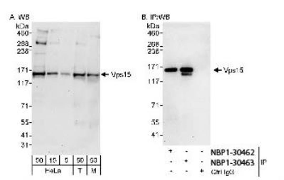 Western Blot: PIK3R4 Antibody [NBP1-30463] - Whole cell  lysate from HeLa, 293T and mouse NIH3T3 cells. Vps15 was also immunoprecipitated by rabbit anti-Vps15 antibody NBP1-30462.