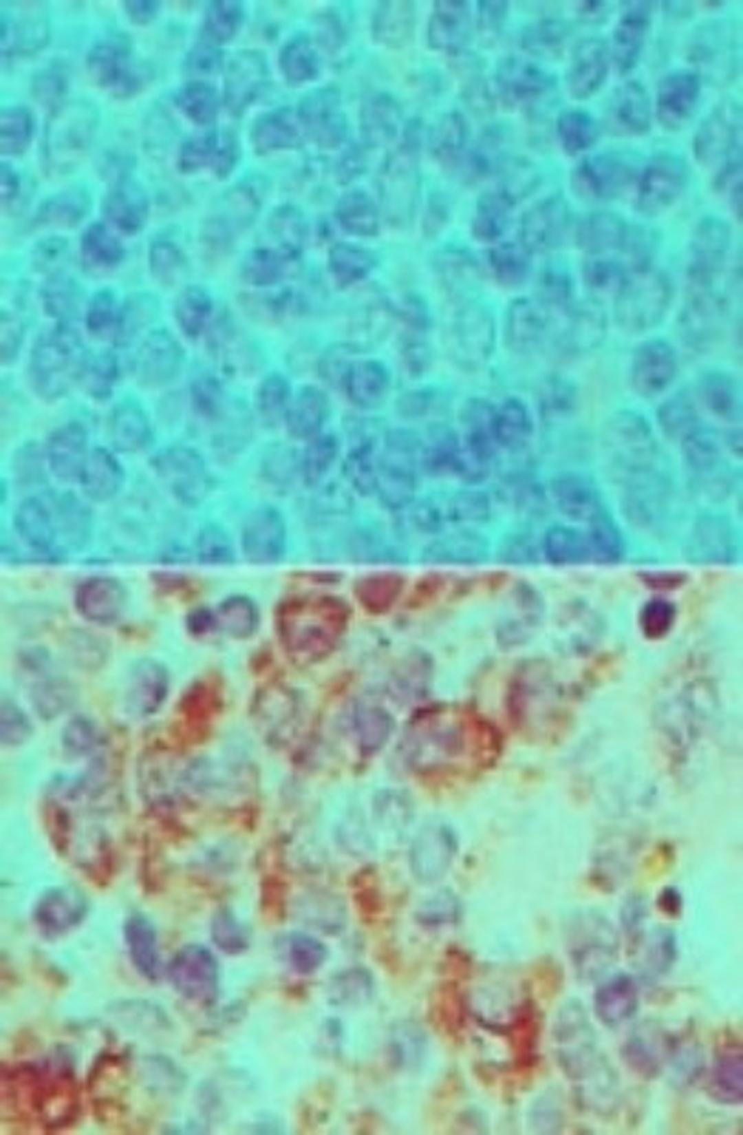 Immunohistochemistry-Paraffin: Importin-7 Antibody [NBP2-27150] - Analysis of IOP7 in formalin-fixed, paraffin-embedded mouse spleen tissue using an isotype control (top) and this antibody (bottom) at 5 ug/ml.