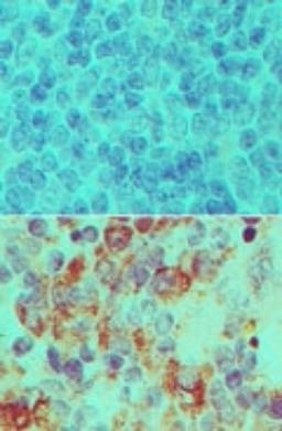 Immunohistochemistry-Paraffin: Importin-7 Antibody [NBP2-27150] - Analysis of IOP7 in formalin-fixed, paraffin-embedded mouse spleen tissue using an isotype control (top) and this antibody (bottom) at 5 ug/ml.