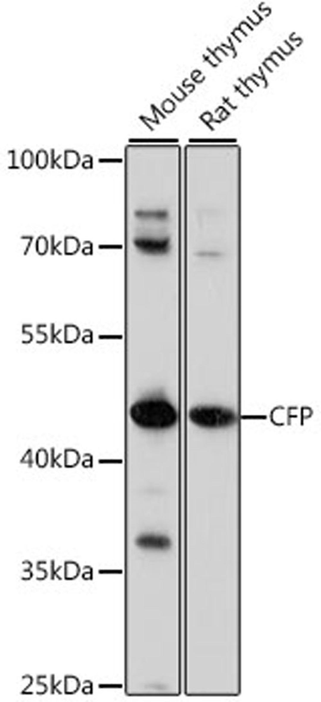 Western blot - CFP antibody (A16414)