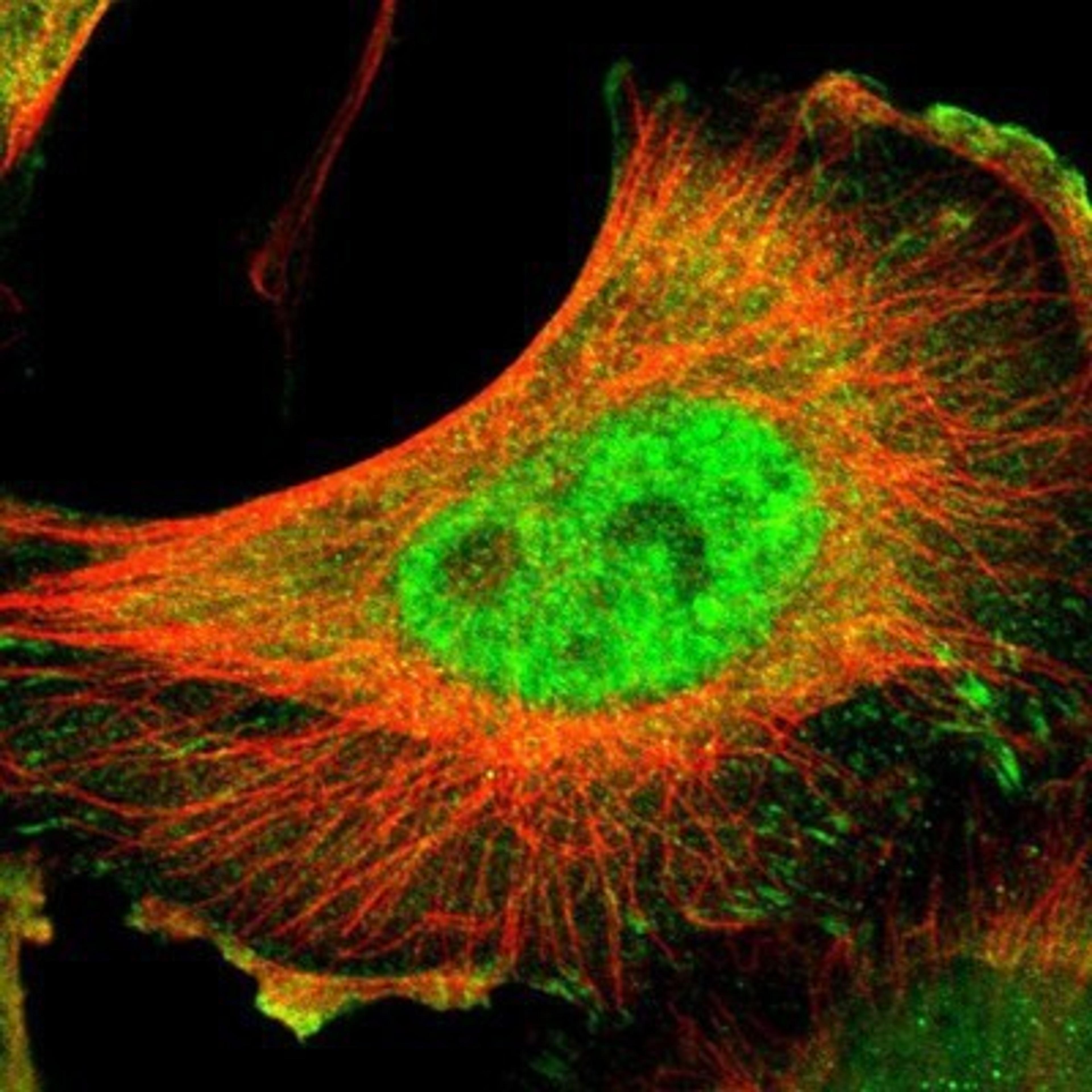 Immunocytochemistry/Immunofluorescence: DNA Ligase IV Antibody [NBP1-87405] - Staining of human cell line U-251MG shows positivity in nucleus but not nucleoli, plasma membrane, cytoplasm & focal adhesions.