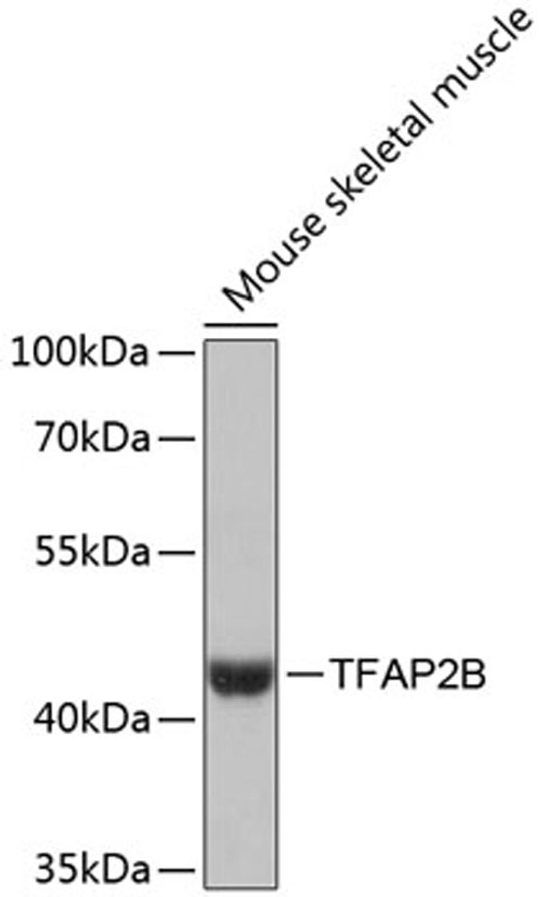 Western blot - TFAP2B antibody (A13885)