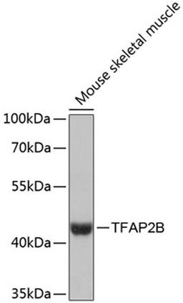 Western blot - TFAP2B antibody (A13885)