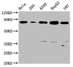 Western Blot. Positive WB detected in: Hela whole cell lysate, 293 whole cell lysate, A549 whole cell lysate, HepG2 whole cell lysate, U87 whole cell lysate. All lanes: BAG3 antibody at 0.73μg/ml. Secondary. Goat polyclonal to rabbit IgG at 1/50000 dilution. Predicted band size: 62 KDa. Observed band size: 80 KDa. 