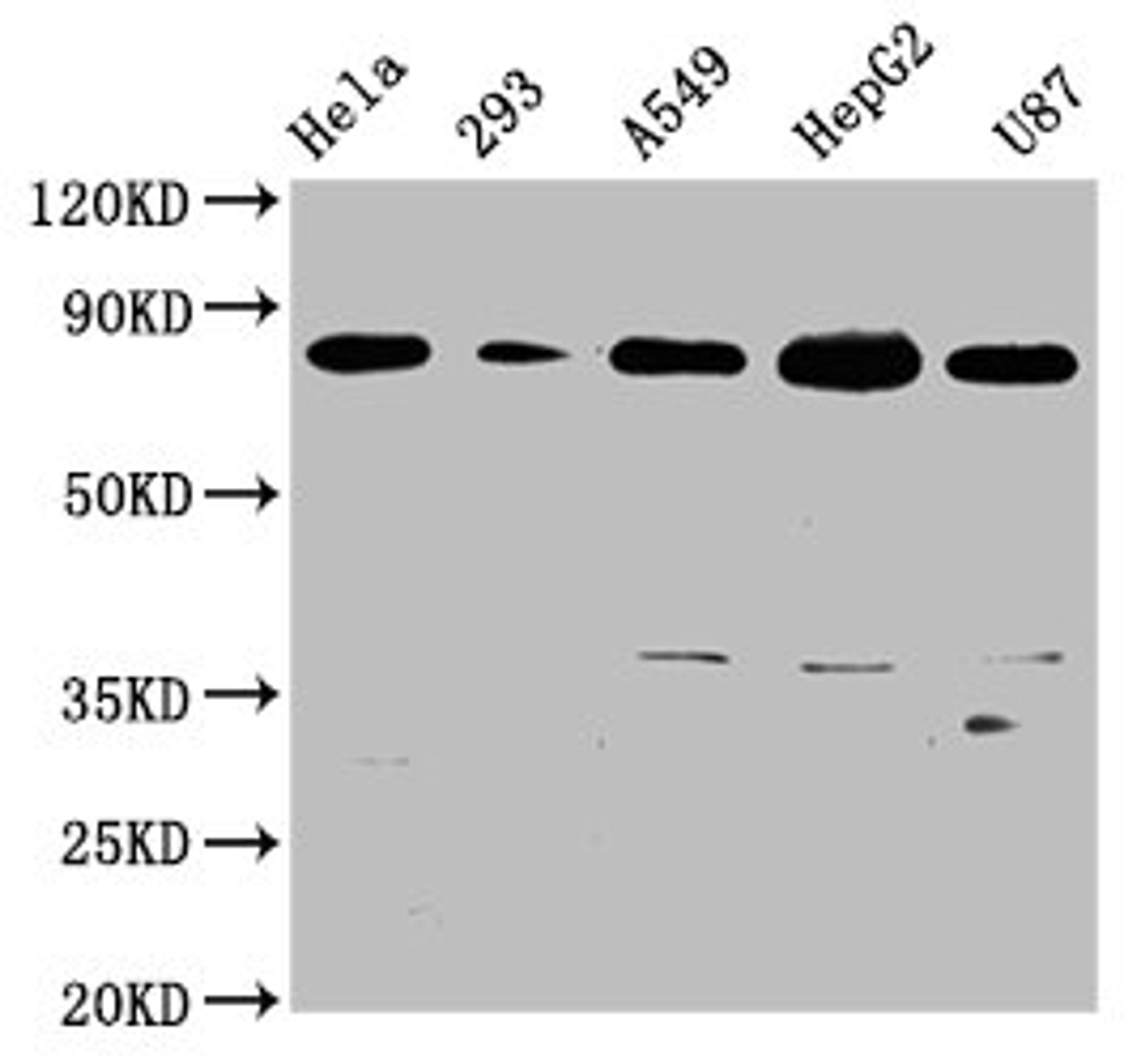 Western Blot. Positive WB detected in: Hela whole cell lysate, 293 whole cell lysate, A549 whole cell lysate, HepG2 whole cell lysate, U87 whole cell lysate. All lanes: BAG3 antibody at 0.73μg/ml. Secondary. Goat polyclonal to rabbit IgG at 1/50000 dilution. Predicted band size: 62 KDa. Observed band size: 80 KDa. 