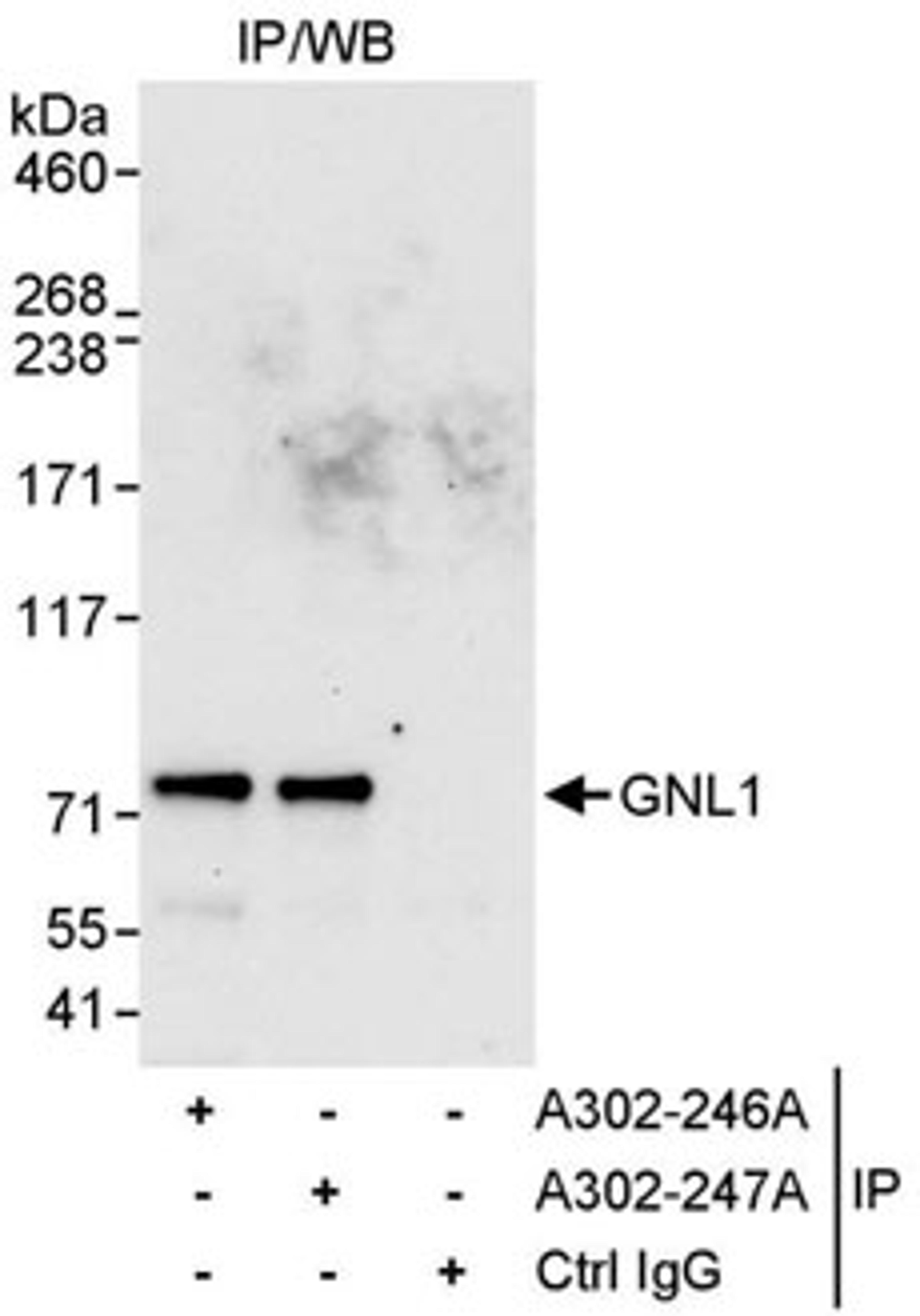 Detection of human GNL1 by western blot of immunoprecipitates.