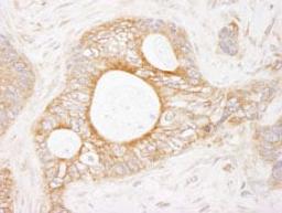 Detection of human eEF2 Kinase by immunohistochemistry.