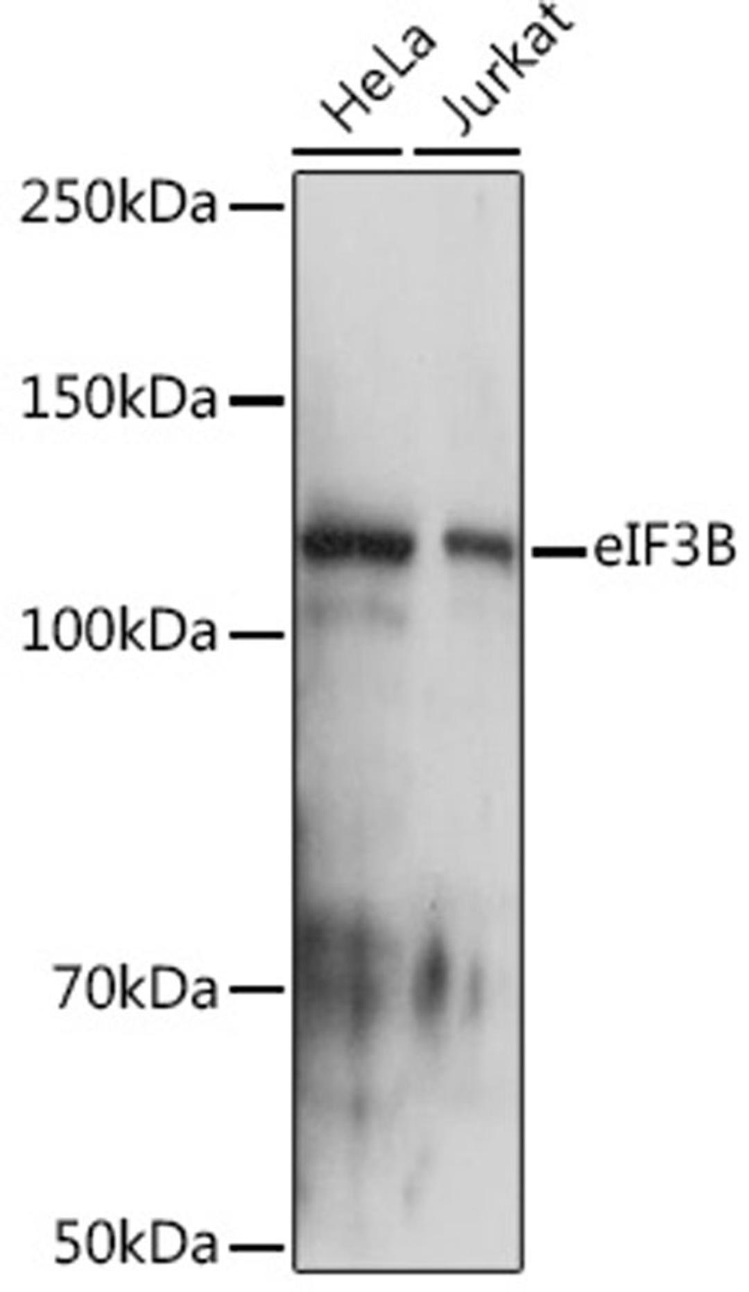 Western blot - eIF3B Rabbit mAb (A9143)