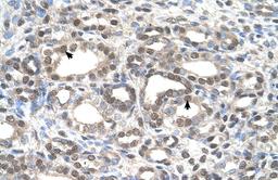 Antibody used in IHC on Human kidney.