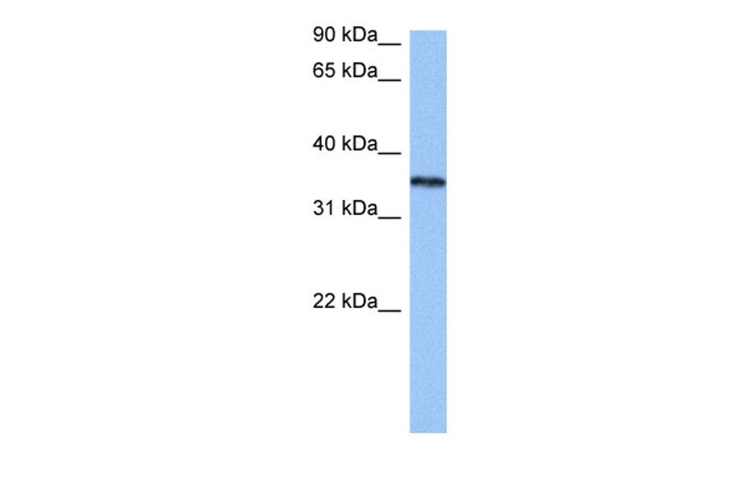 Antibody used in WB on Human Jurkat 0.2-1 ug/ml.