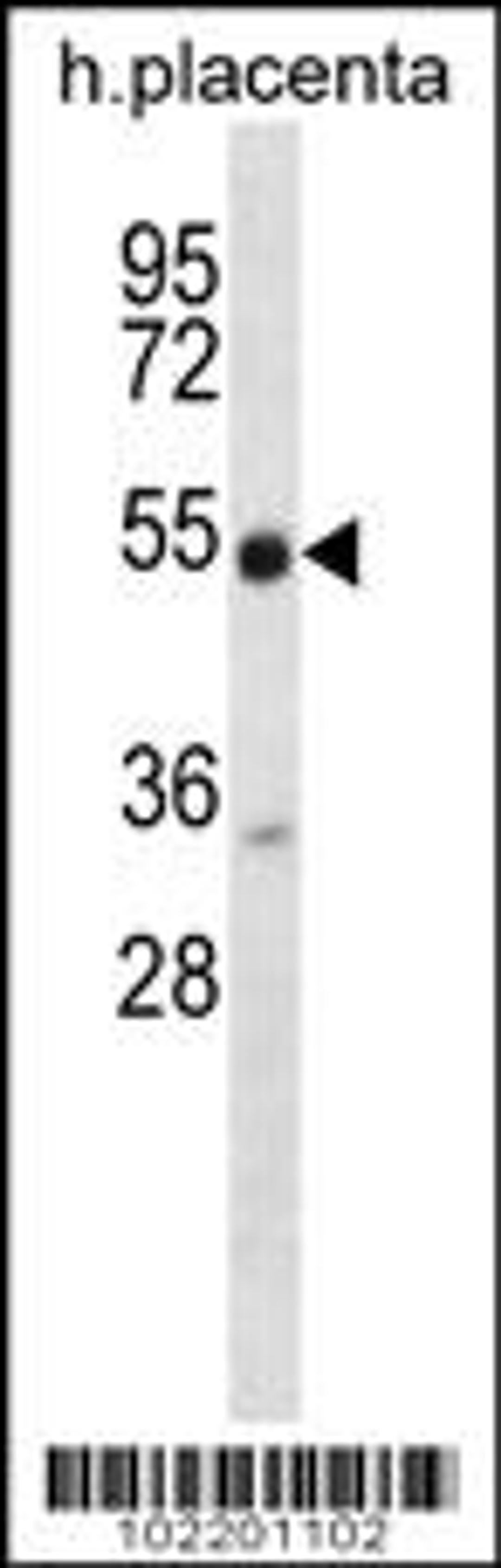 Western blot analysis in human placenta tissue lysates (35ug/lane).