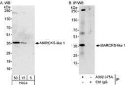 Detection of human MARCKS-like 1 by western blot and immunoprecipitation.