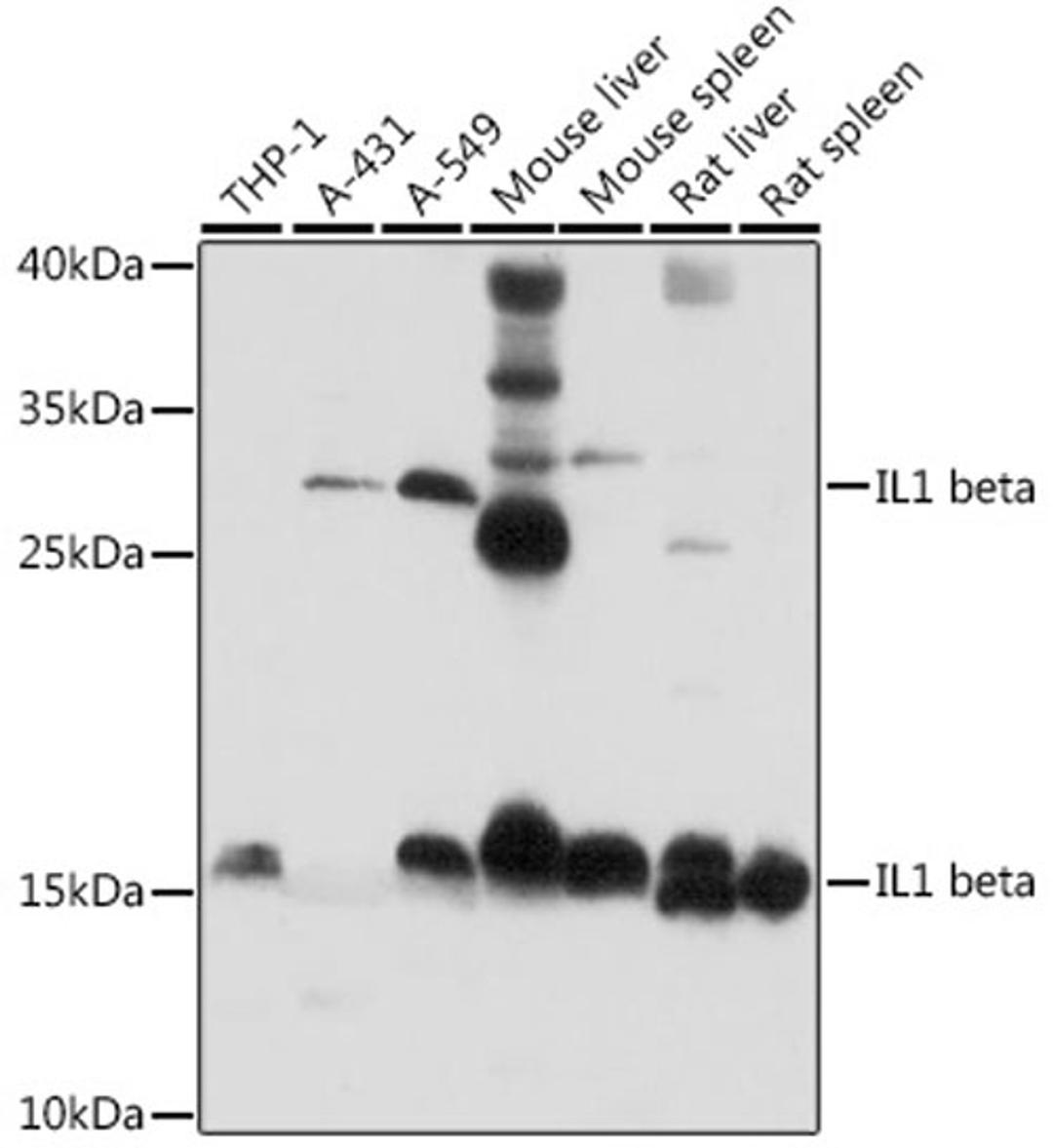 Western blot - IL1 beta antibody (A11369)