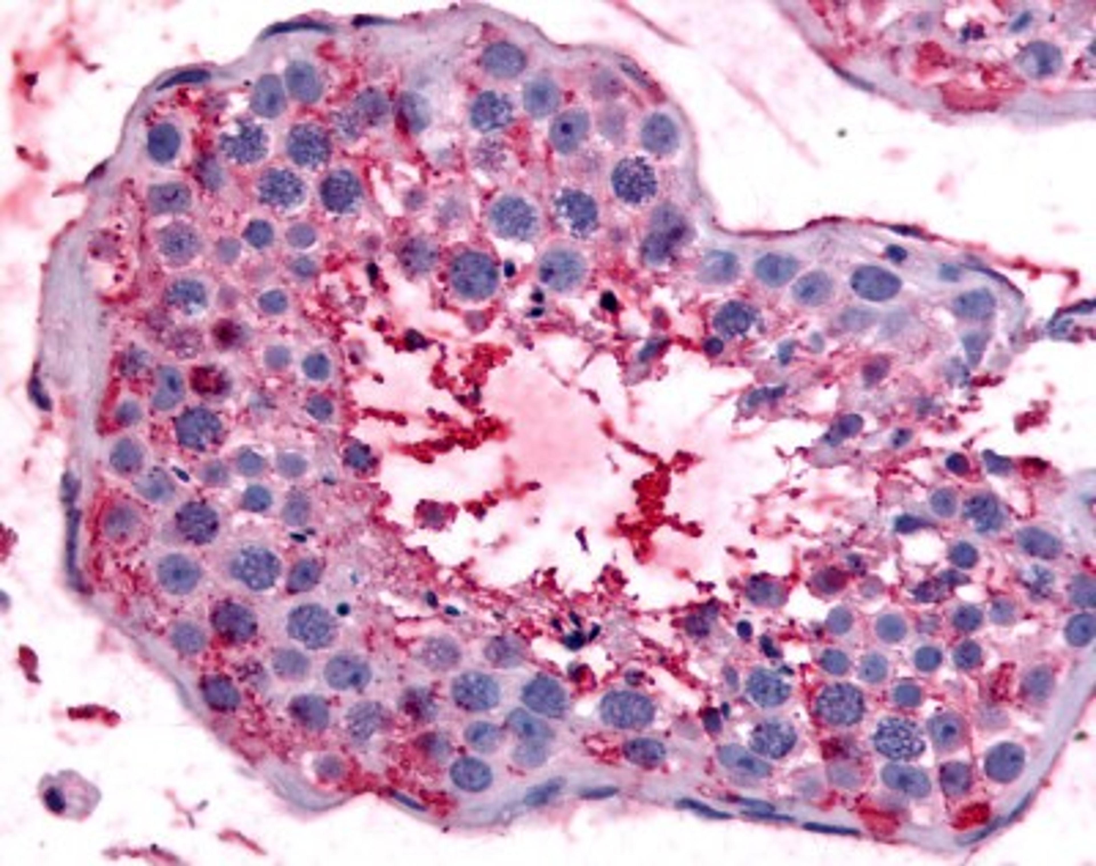 Immunohistochemistry-Paraffin: Bestrophin 2 Antibody [NB110-55620] - Analysis of anti-BEST2 / Bestrophin-2 antibody with human testis.