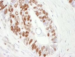 Detection of human MCM6 by immunohistochemistry.