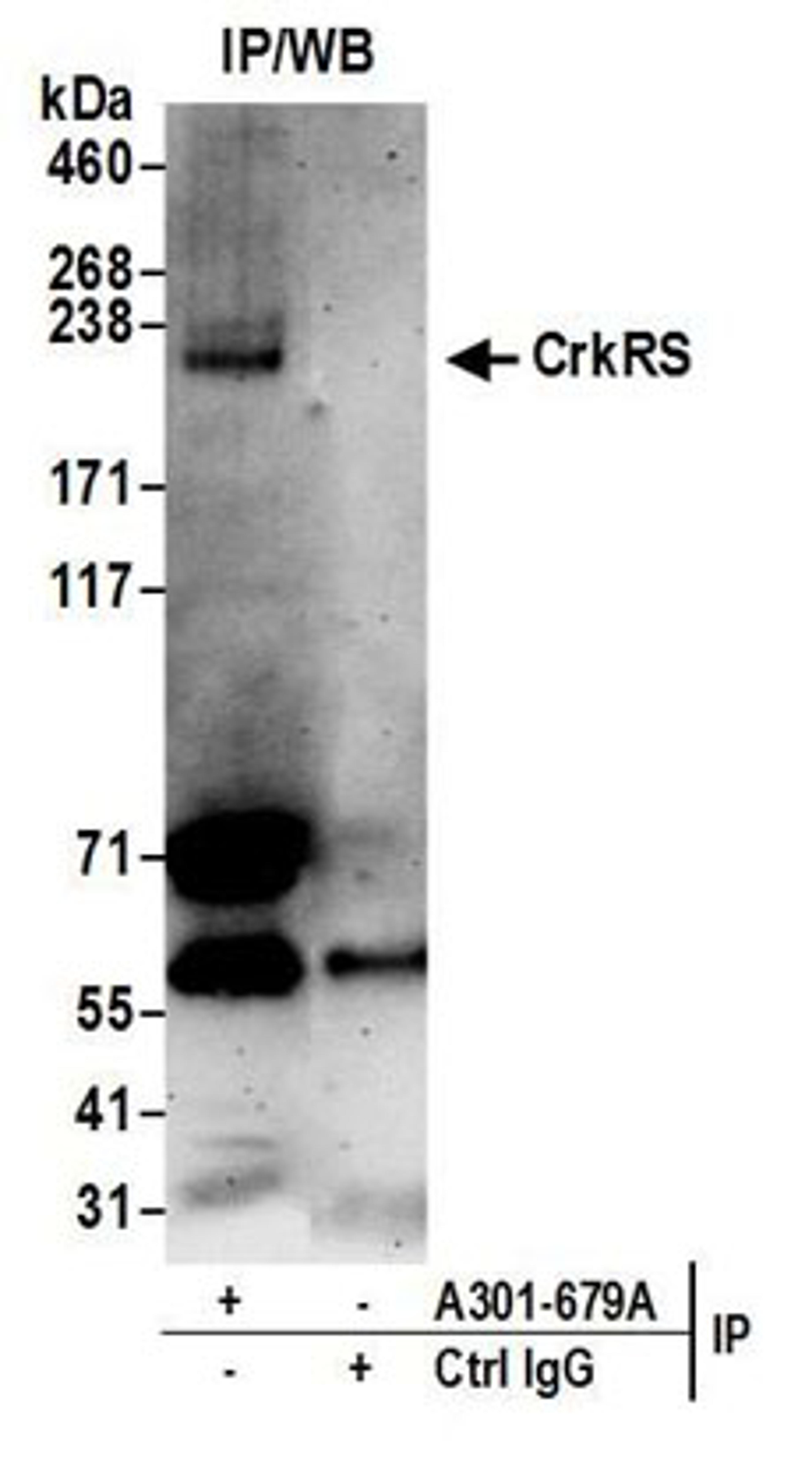 Detection of human CrkRS by western blot of immunoprecipitates.