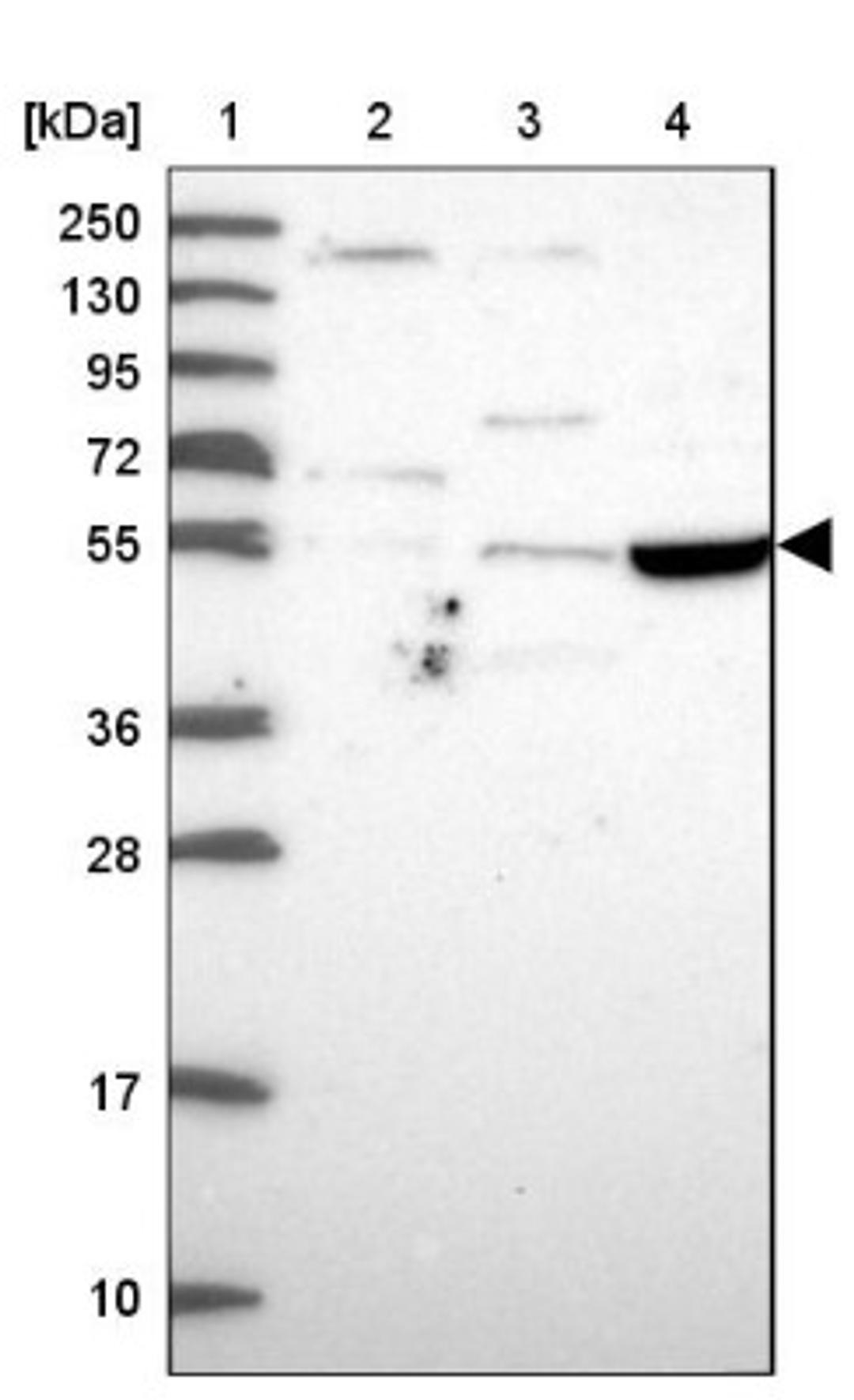 Western Blot: TSPYL4 Antibody [NBP1-92541] - Lane 1: Marker [kDa] 250, 130, 95, 72, 55, 36, 28, 17, 10<br/>Lane 2: Human cell line RT-4<br/>Lane 3: Human cell line U-251MG sp<br/>Lane 4: Human plasma (IgG/HSA depleted)