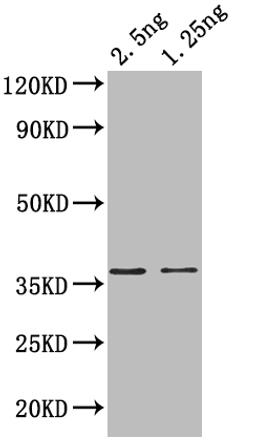 Western Blot. Positive WB detected in: recombinant protein. All lanes: hupB Antibody at 1:1000. Secondary. Goat polyclonal to rabbit IgG at 1/50000 dilution. Predicted band size: 35 kDa. Observed band size: 37 kDa. 