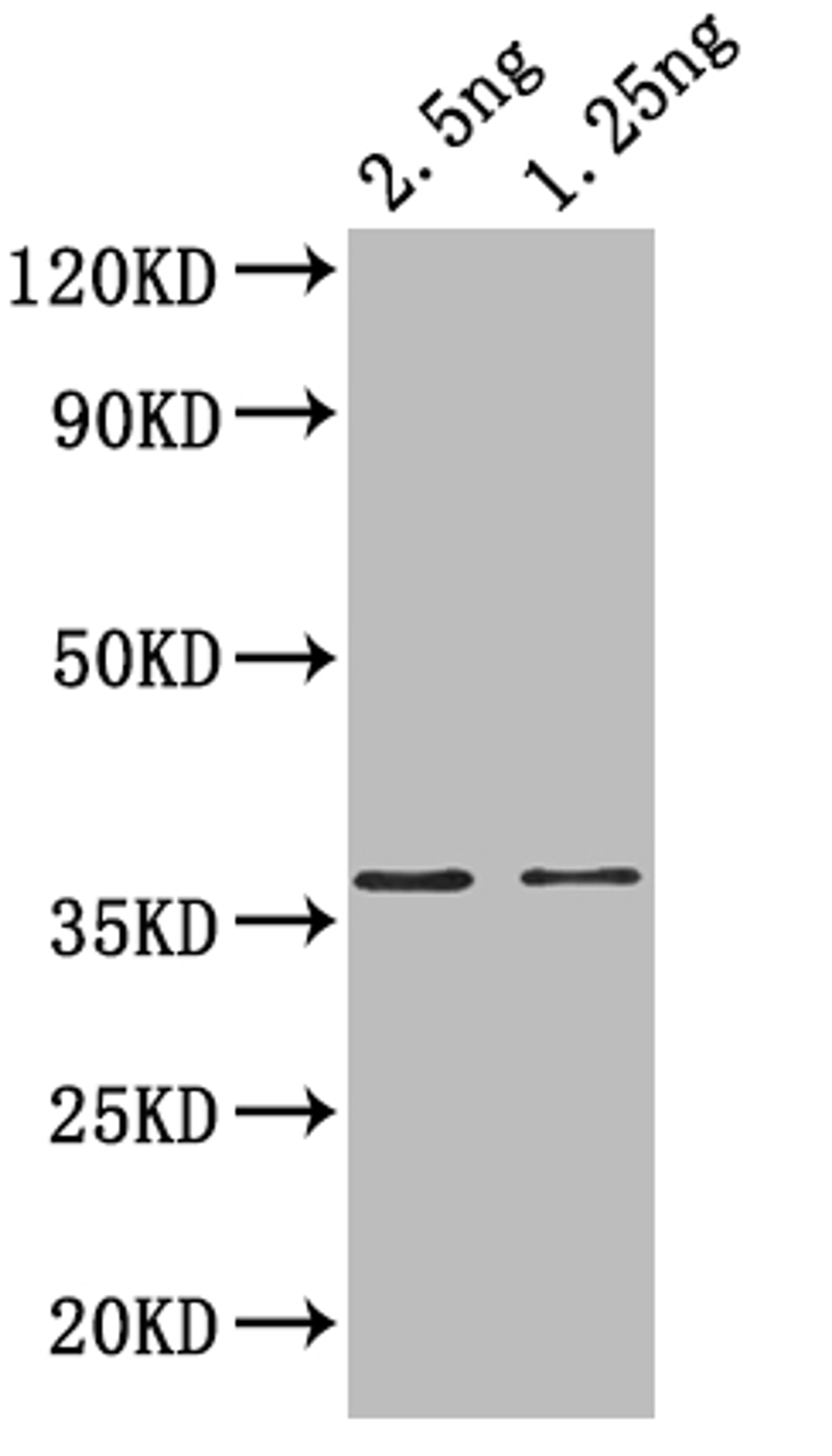 Western Blot. Positive WB detected in: recombinant protein. All lanes: hupB Antibody at 1:1000. Secondary. Goat polyclonal to rabbit IgG at 1/50000 dilution. Predicted band size: 35 kDa. Observed band size: 37 kDa. 