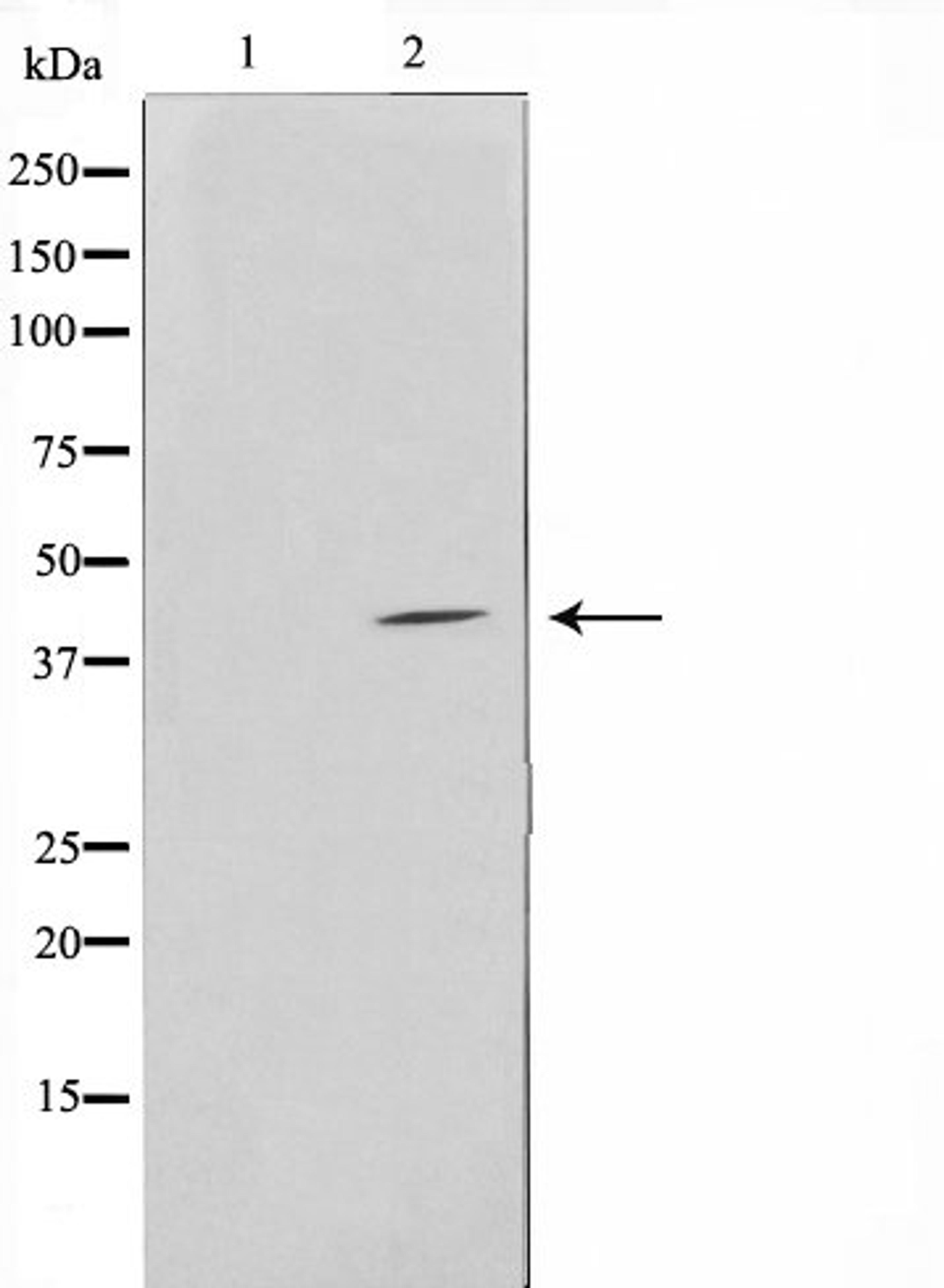 Western blot analysis of LOVO cell lysate using ERGI3 antibody