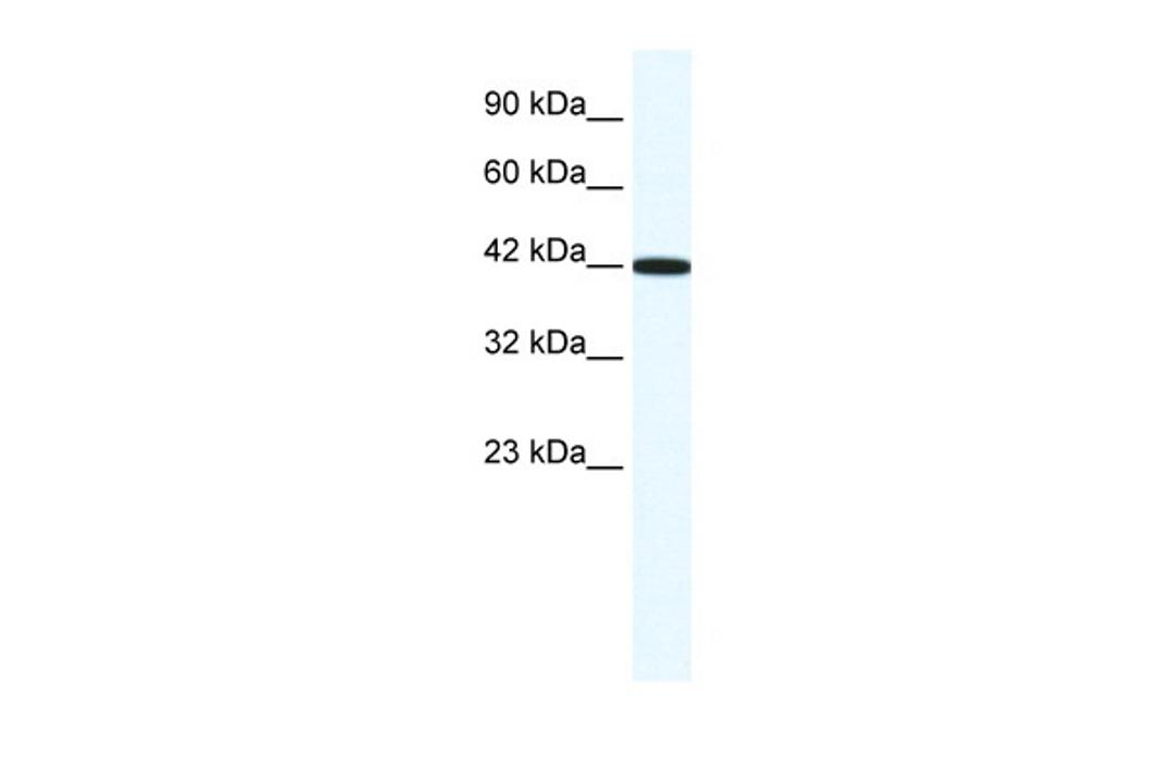 Antibody used in WB on Human HepG2 at 1.25 ug/ml.