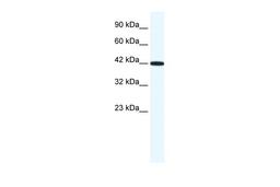 Antibody used in WB on Human HepG2 at 1.25 ug/ml.