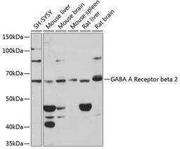 Western blot - GABA A Receptor beta 2 Rabbit mAb (A11558)