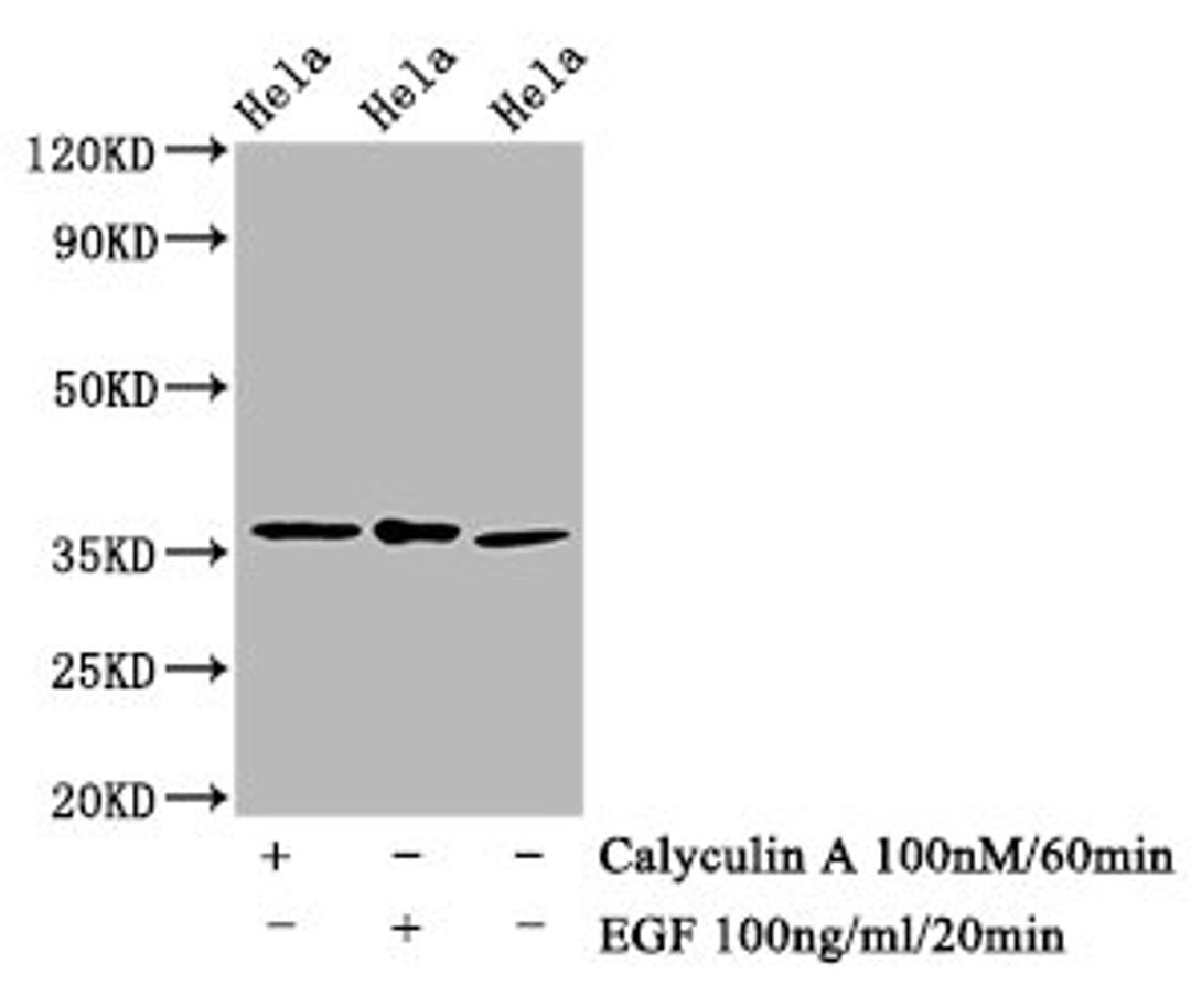 Western Blot. Positive WB detected in Hela whole cell lysate(treated with Calyculin A or EGF) . All lanes Phospho-EIF2S1 antibody at 1.48μg/ml. Secondary. Goat polyclonal to rabbit IgG at 1/50000 dilution. Predicted band size: 36 KDa. Observed band size: 36 KDa.