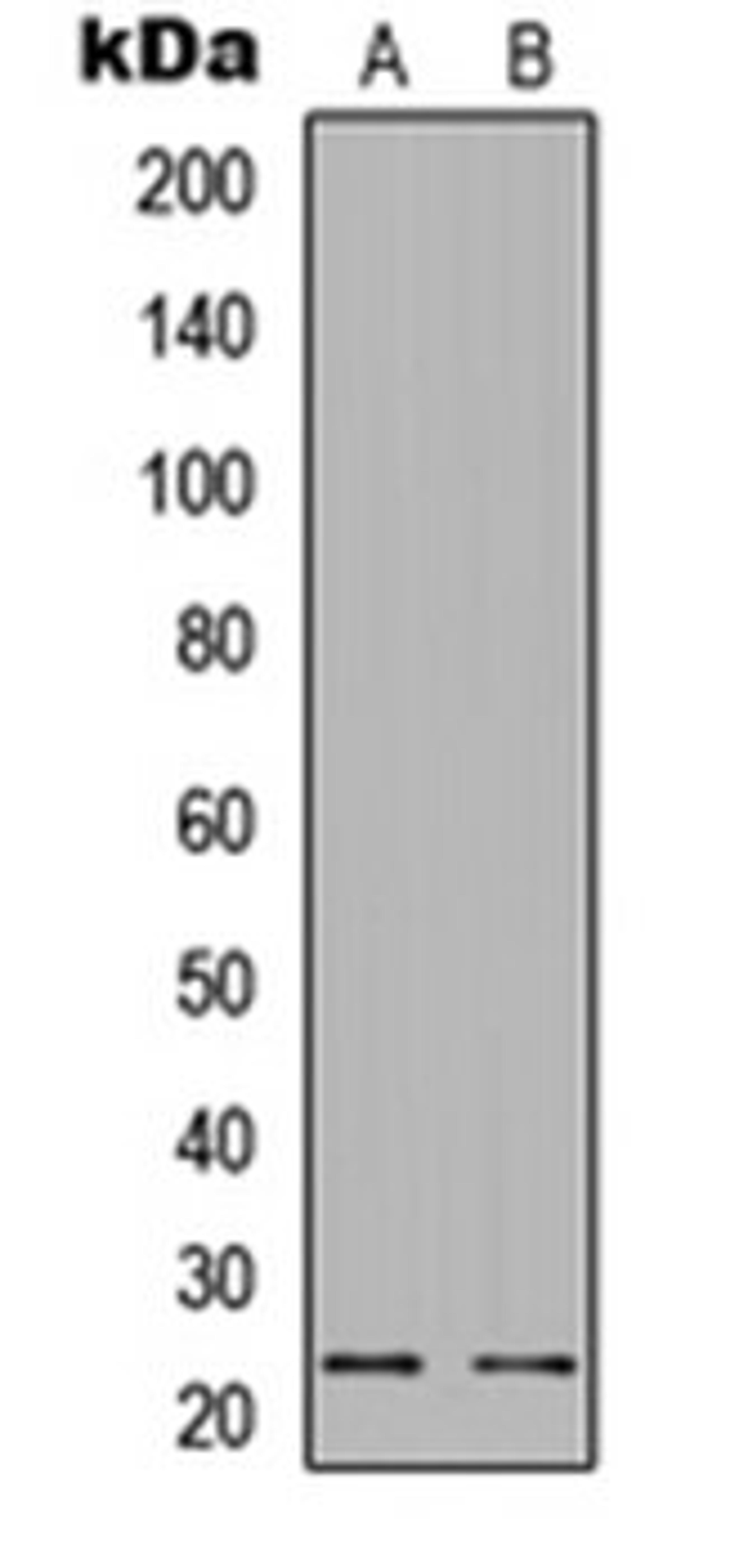 Western blot analysis of HeLa Forskolin-treated (Lane 1), MCF7 (Lane 2) whole cell lysates using BAD (phospho-S112) antibody